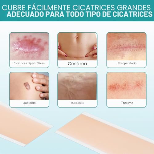 Detalle de NVXNMSD Silicone Scar Sheets: Parches de Silicona para Cicatrices Verdes, 1.6'' x 60