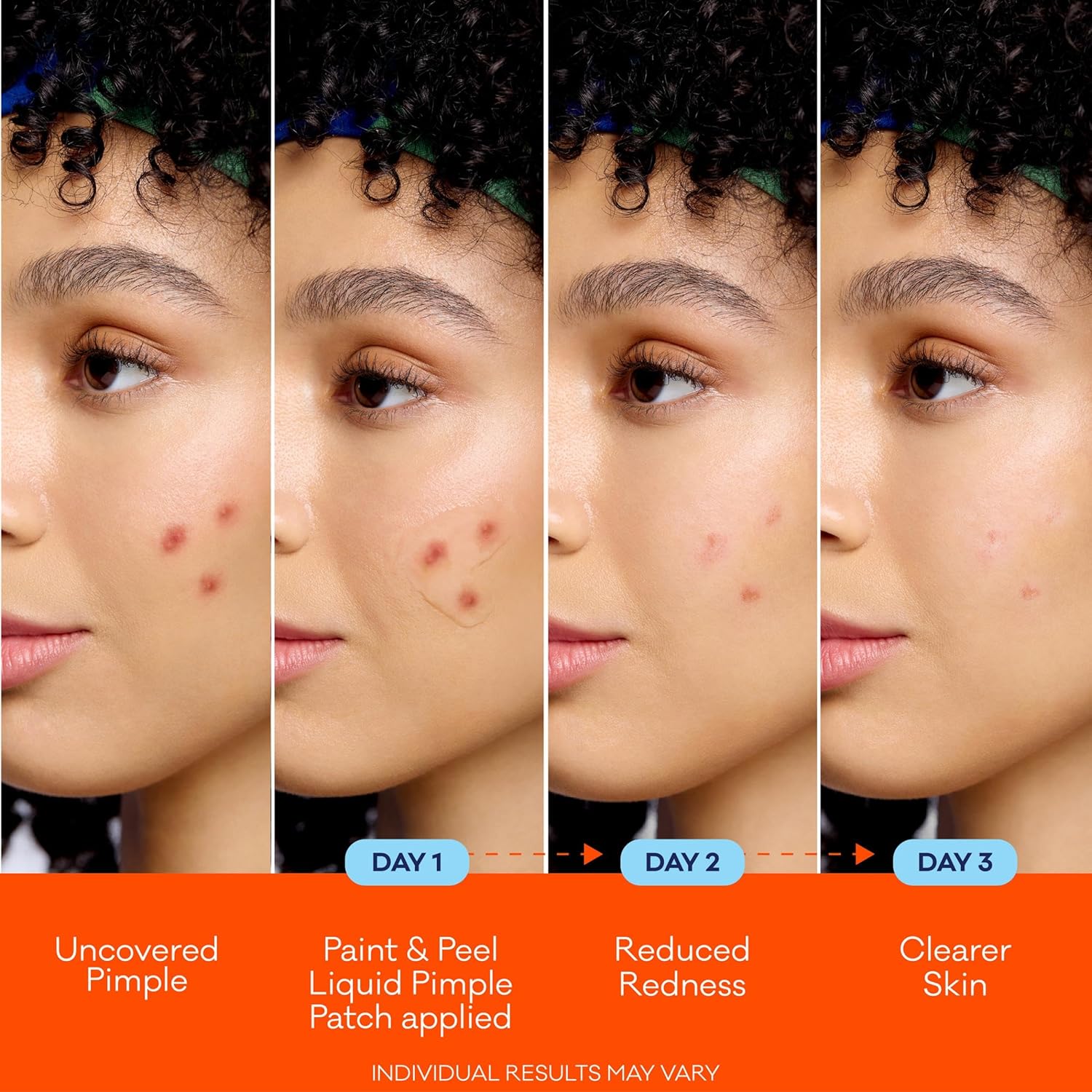 Detalle de Bioré Paint & Peel Liquid Pimple Patch with 1% Salicylic Acid (Up to 100 Uses), .5 Oz