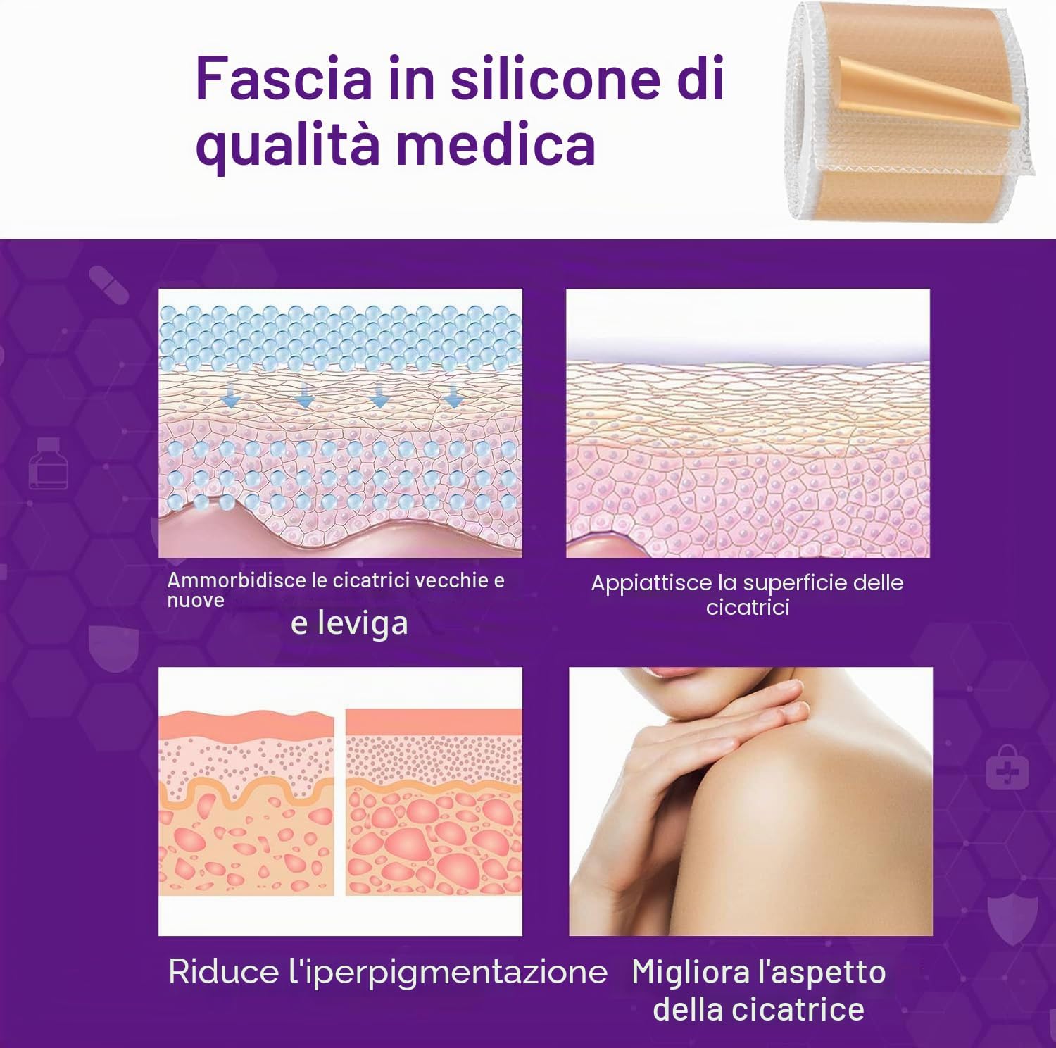 Thumbnail 1 de 1.5M Fogli di silicone cicatrici – fornitura di 6 mesi, riutilizzabili e delicati sulla pelle