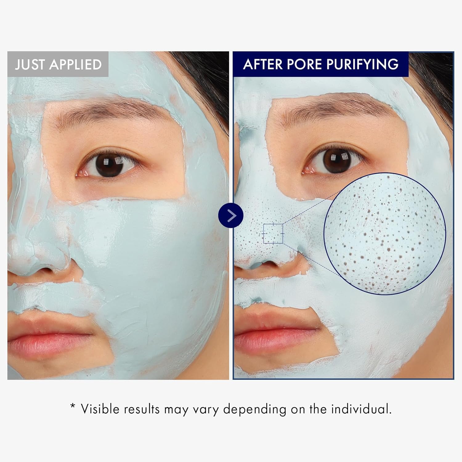 Detalle de TOSOWOONG Real Blackhead Mud Mask: Deep Pore Purifying Korean Clay for Oil Control