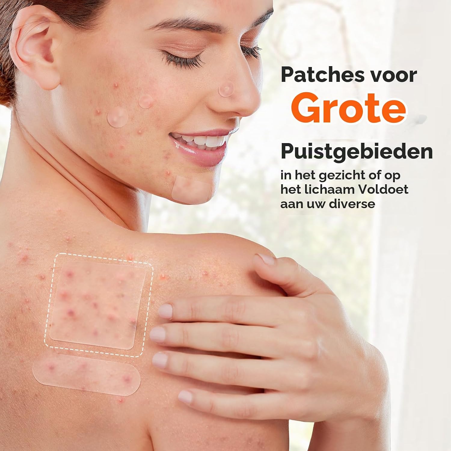 Detalle de TKTK XL-puistjespatches van hydrocolloïd, 5 maten, 120 stuks