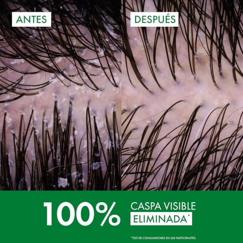 Thumbnail 3 de Vichy Dercos Technique Champú anticaspa purificante para cabello seco, 390 ml