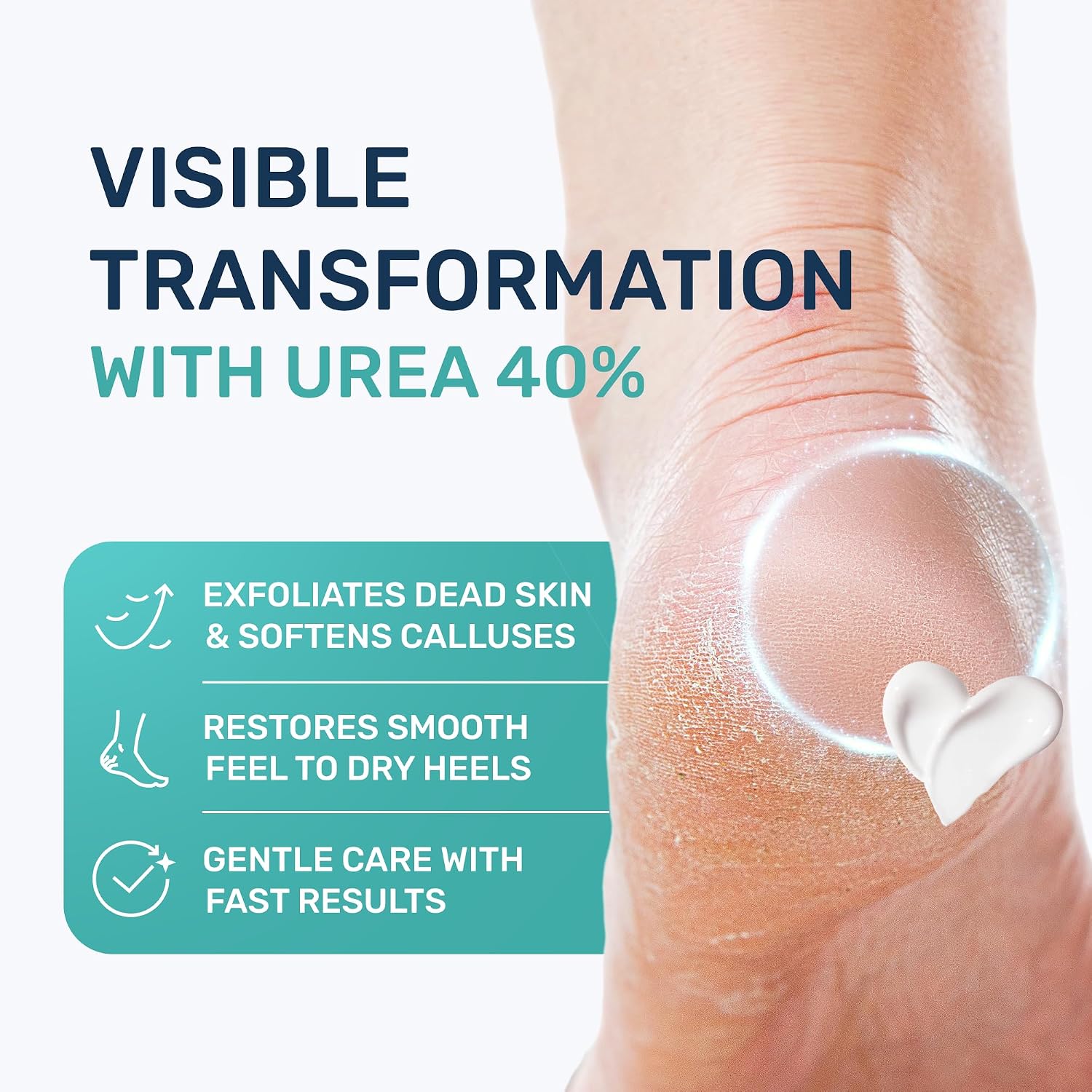 Detalle 2 de PROJECT 701 Urea Cream 40% for Feet