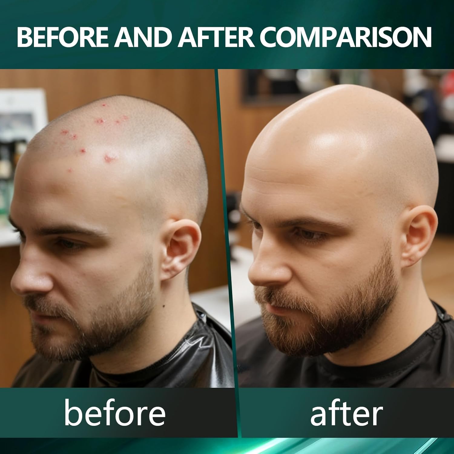 Thumbnail 1 de 50ml Crema Teste Rasate: idratante e lenitiva per cuoio capelluto calvo