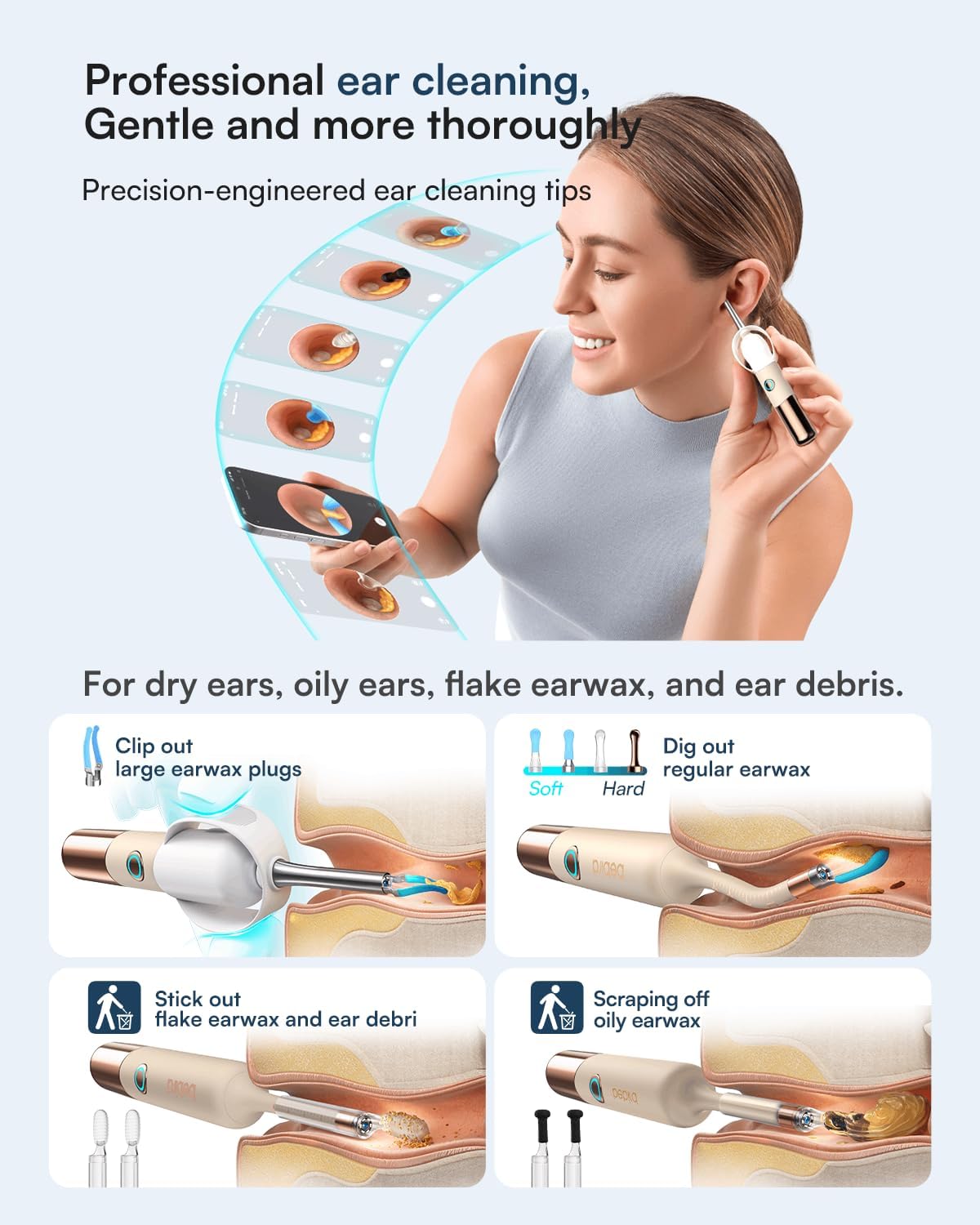 Detalle de Bebird Earsight Ultra Ear Wax Removal Kit with 2K HD Camera (Wireless, 90-Minute Battery)
