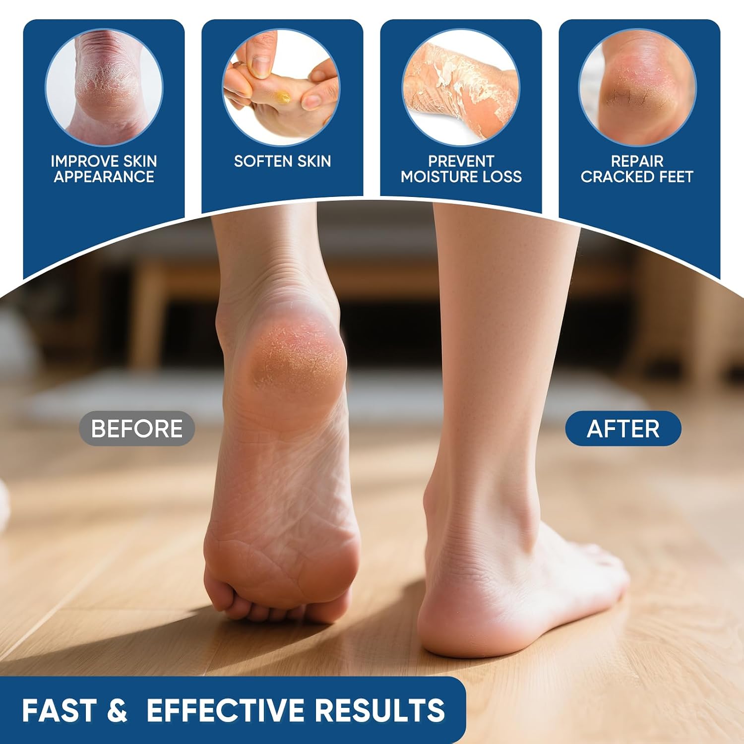 Detalle 2 de VREKEF Urea Cream 40% for Feet