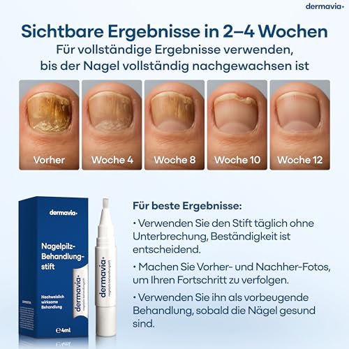 Detalle de DERMAVIA+ Nagelpilzbehandlung – Präzise 4 ml Drehstiftformel für Nagel- und Hautinfektionen
