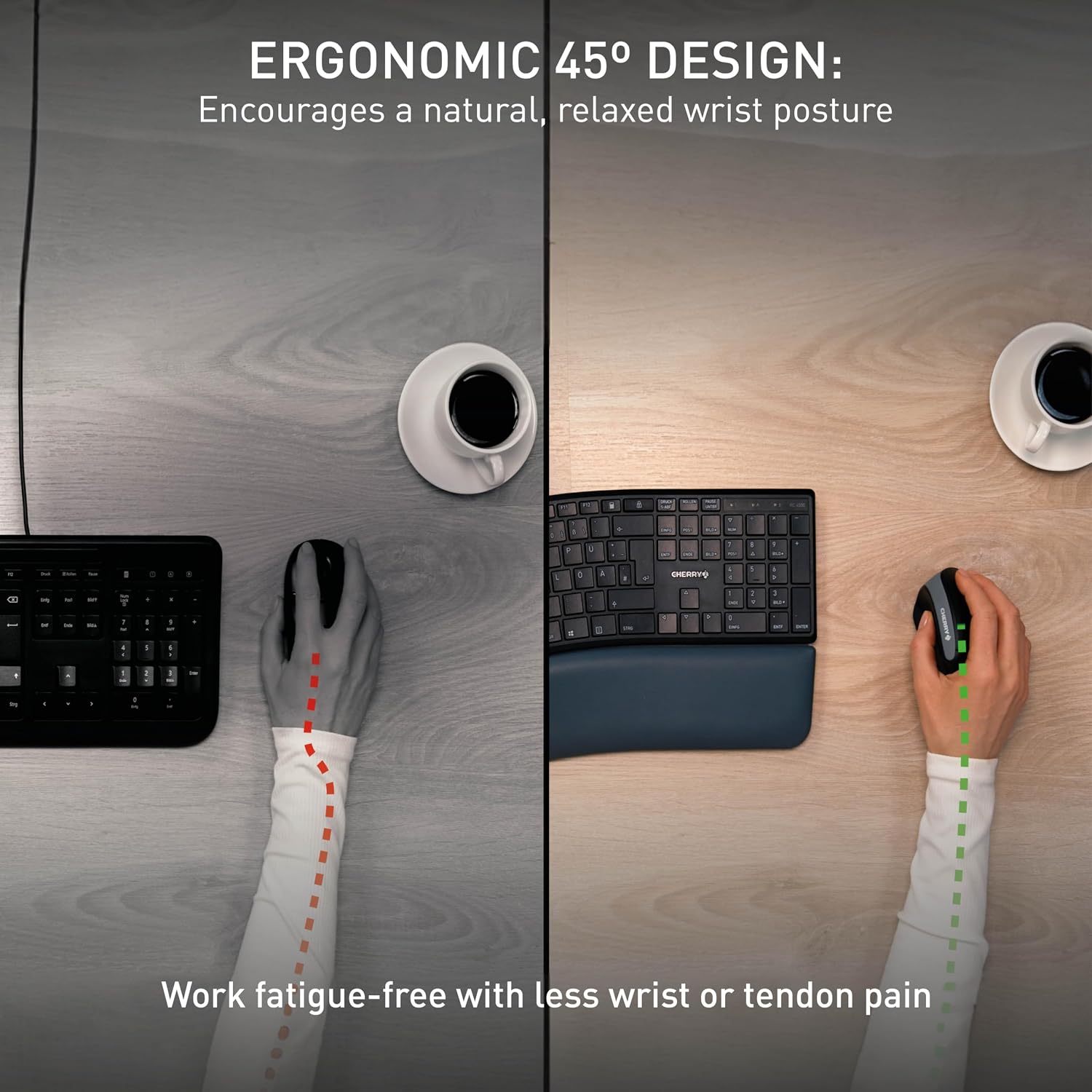 Thumbnail 3 de Cherry MW 4500 Ergonomic Vertical Mouse