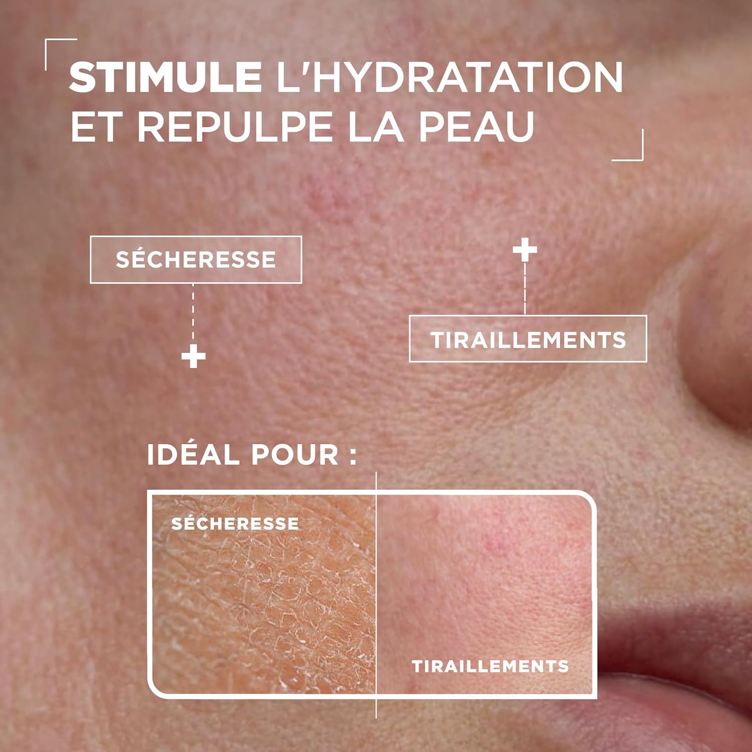 Thumbnail 2 de Mixa Siero concentrato reidratante per pelli disidratate e sensibili – 30 ml