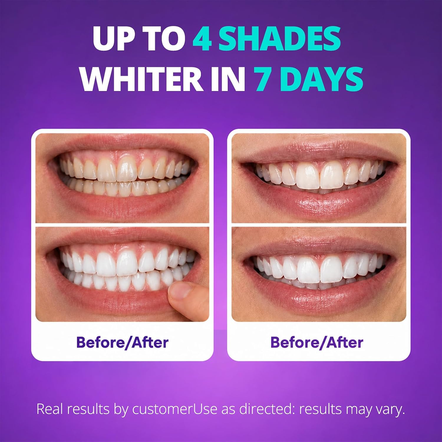 Detalle de SAKYPRORAL Whitening Strips: Purple Color-Correcting + 6% Hydrogen Peroxide, 14-Count