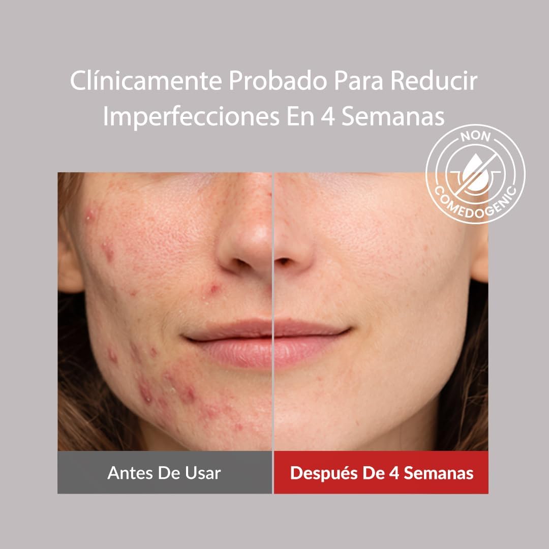 Thumbnail 4 de MIZON Good Bye Blemish Limpiador pH bajo