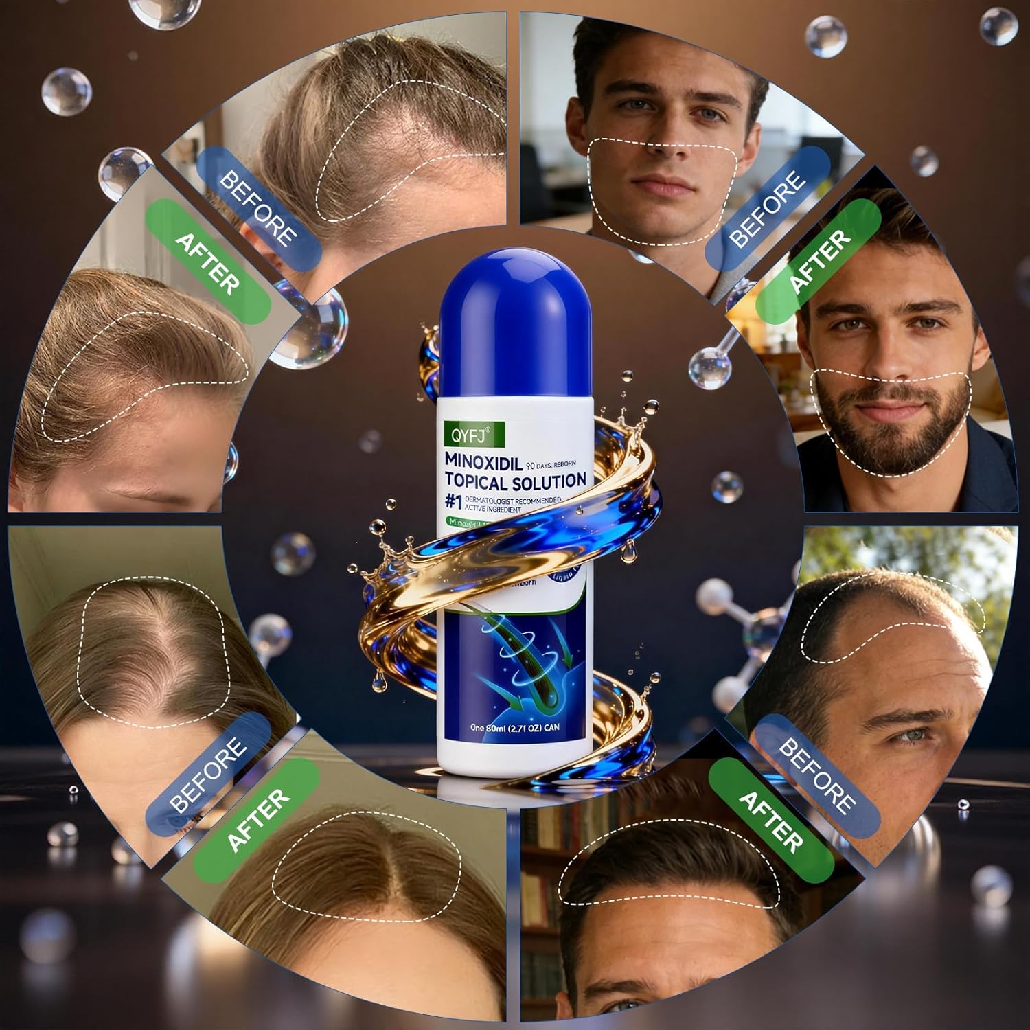Detalle de 6 Pack 5% Minoxidil Hair & Beard Growth Serum with Sponge Applicator (Unscented, Biotin-Infused) — 2.7 fl oz x 6