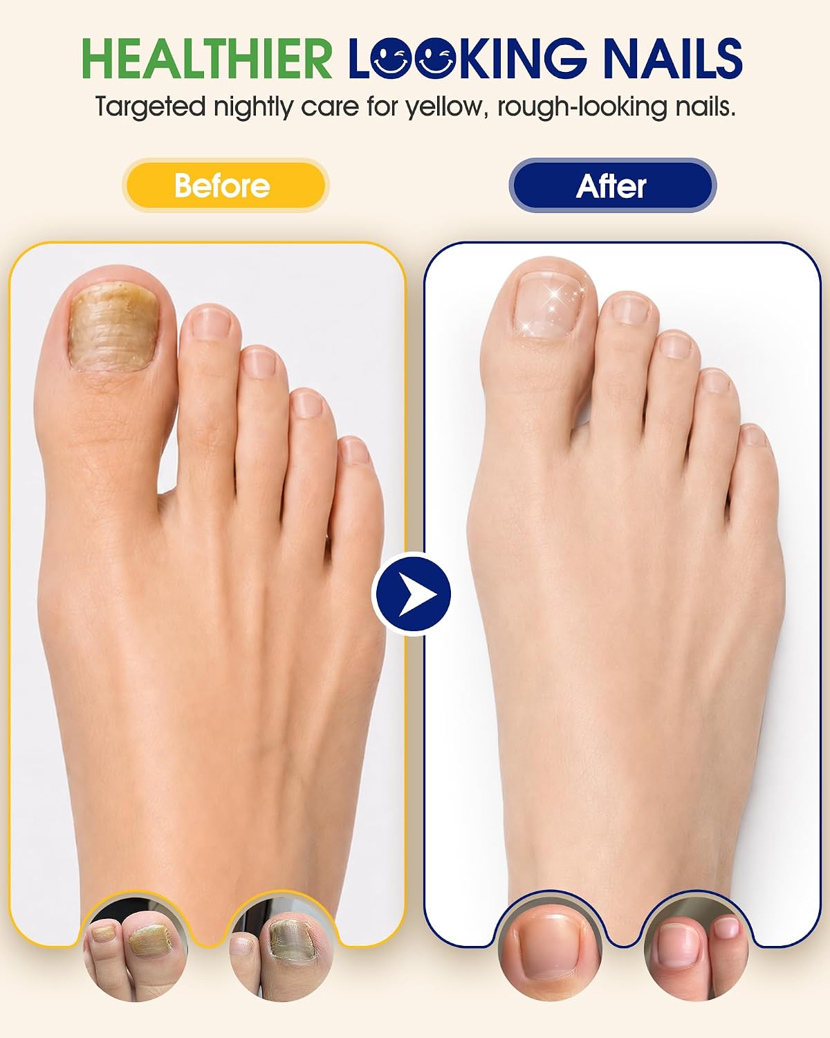Detalle 2 de Fungal Nail Patches, 42 patches
