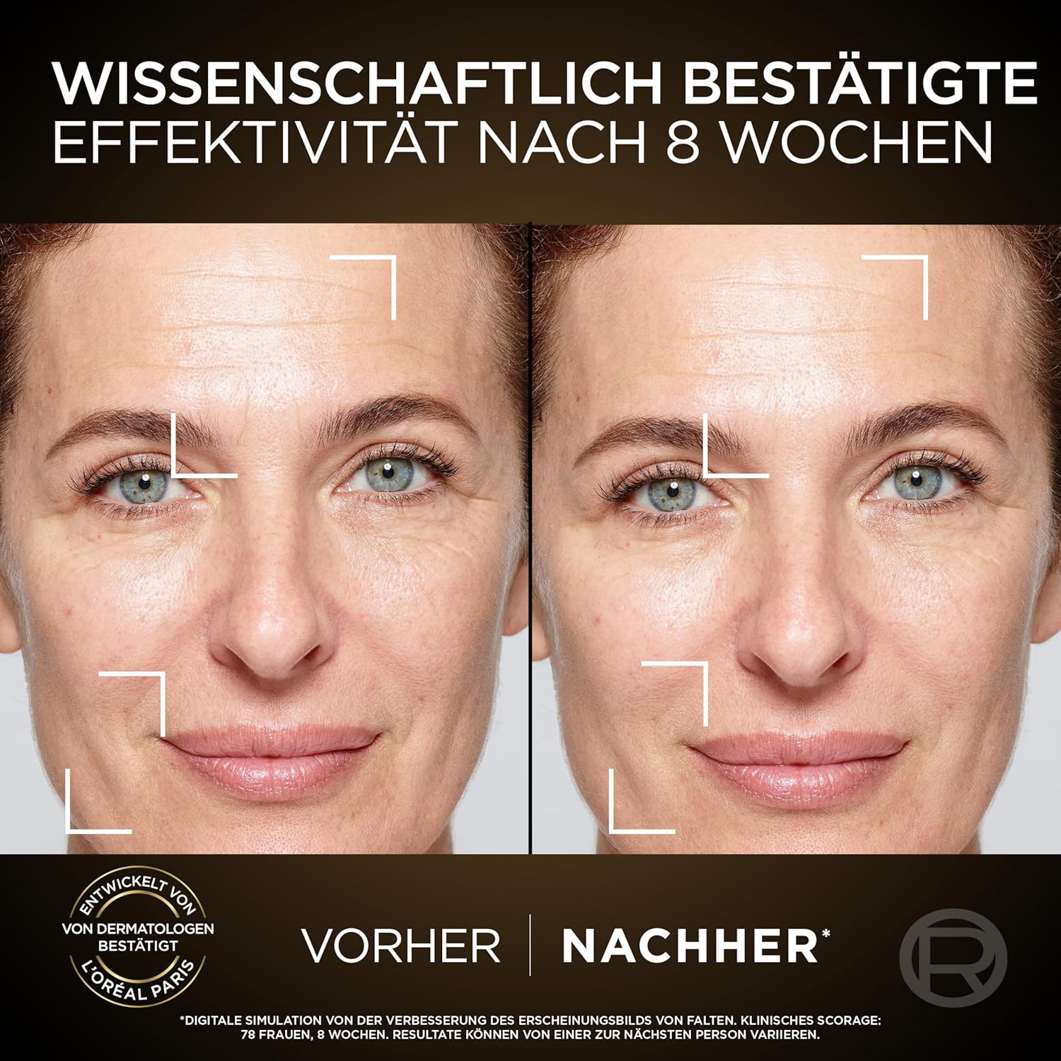 Thumbnail 4 de L'Oréal Paris Age Perfect Zell Renaissance Gesichtspflege-Set – Anti-Aging Tages- und Nachtpflege, 2 × 50 ml