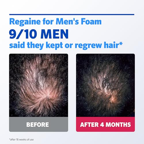 Thumbnail 3 de Regaine For Men Extra Strength Foam: 5% Minoxidil for Hair Regrowth (3x73ml)