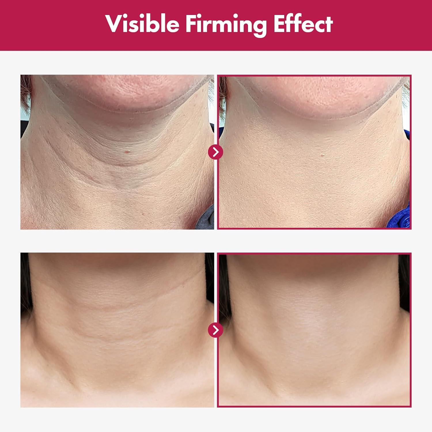 Thumbnail 2 de TOSOWOONG Collagen Necktox crema rassodante per collo con collagene e acido ialuronico, 50 ml