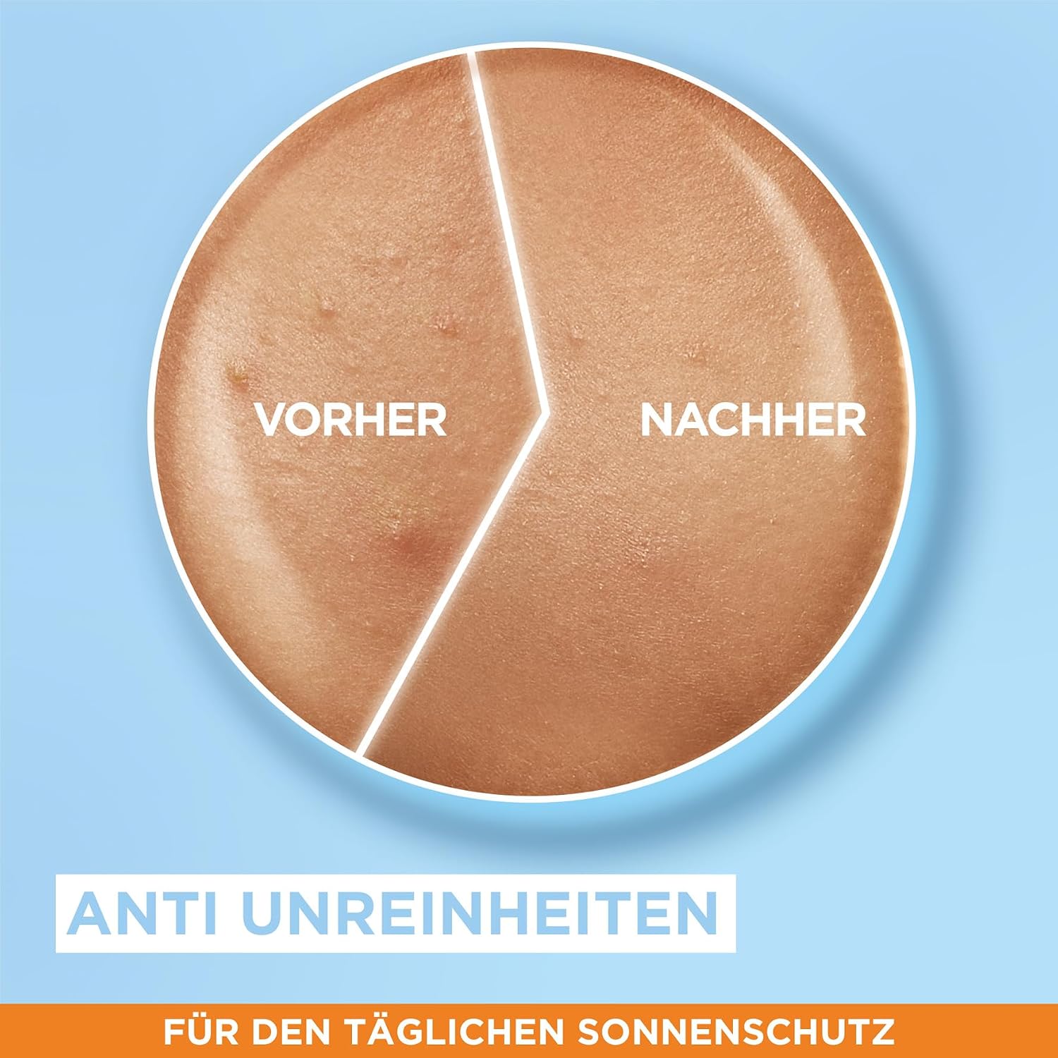 Detalle de Garnier Ambre Solaire Ultra-Hoher UV-Schutz mit Niacinamid für unreine Haut, 40 ml