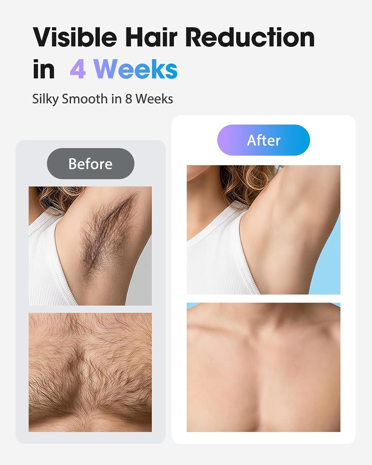 Thumbnail 2 de Haarlosy IPL Laser Hair Removal Device with Ice Cooling (999,900 flashes) for Face, Bikini Line & All Body