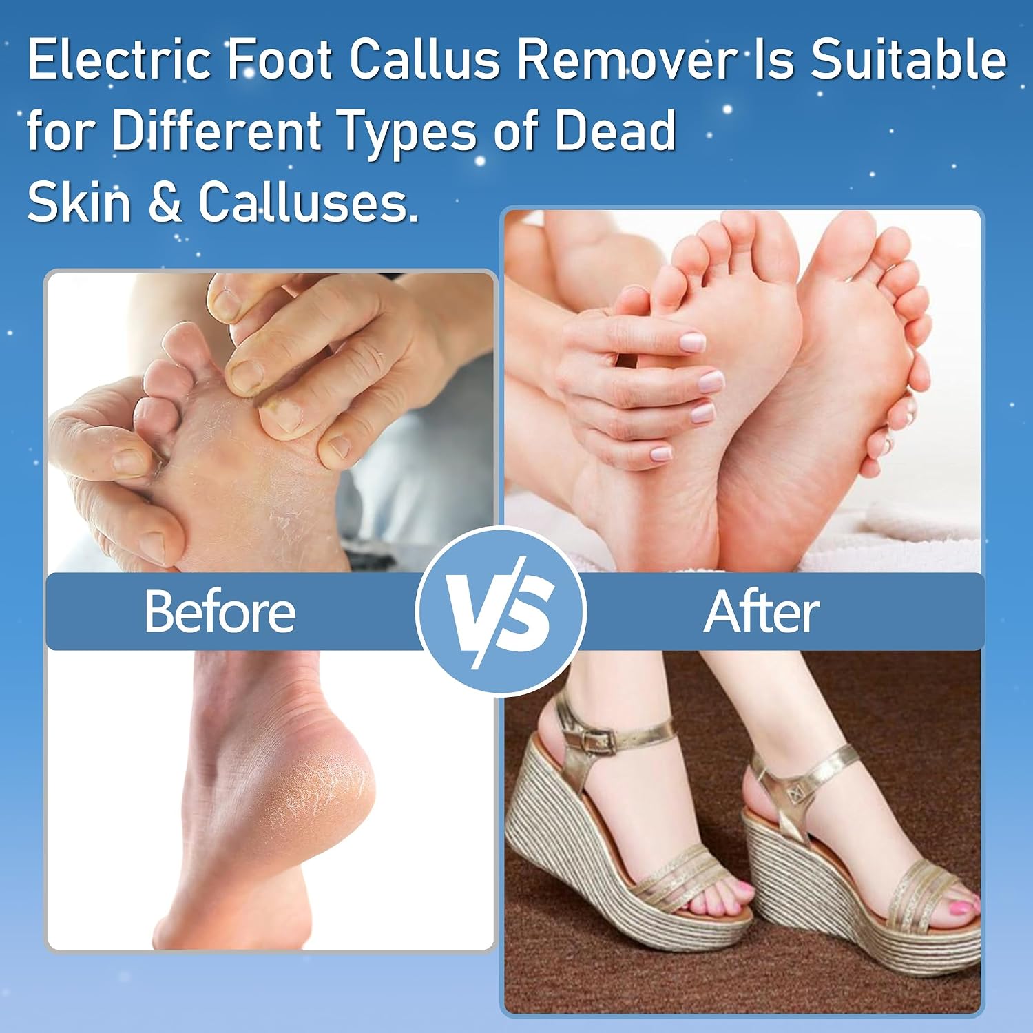 Detalle de Jamestry Callus Remover for Feet — Electric Foot File with 3 Rollers, 2 Speeds, Waterproof Design and 17-in-1 Pedicure Kit
