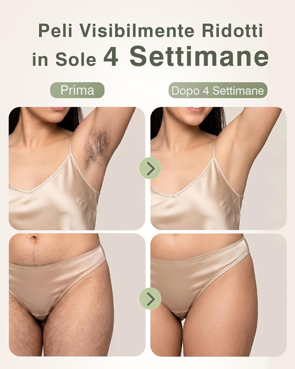 Thumbnail 5 de TIIMAGIC Epilatore Luce Pulsata con Raffreddamento 5°C – 9 livelli, 16J, per Corpo, Ascelle, Bikini e Gambe