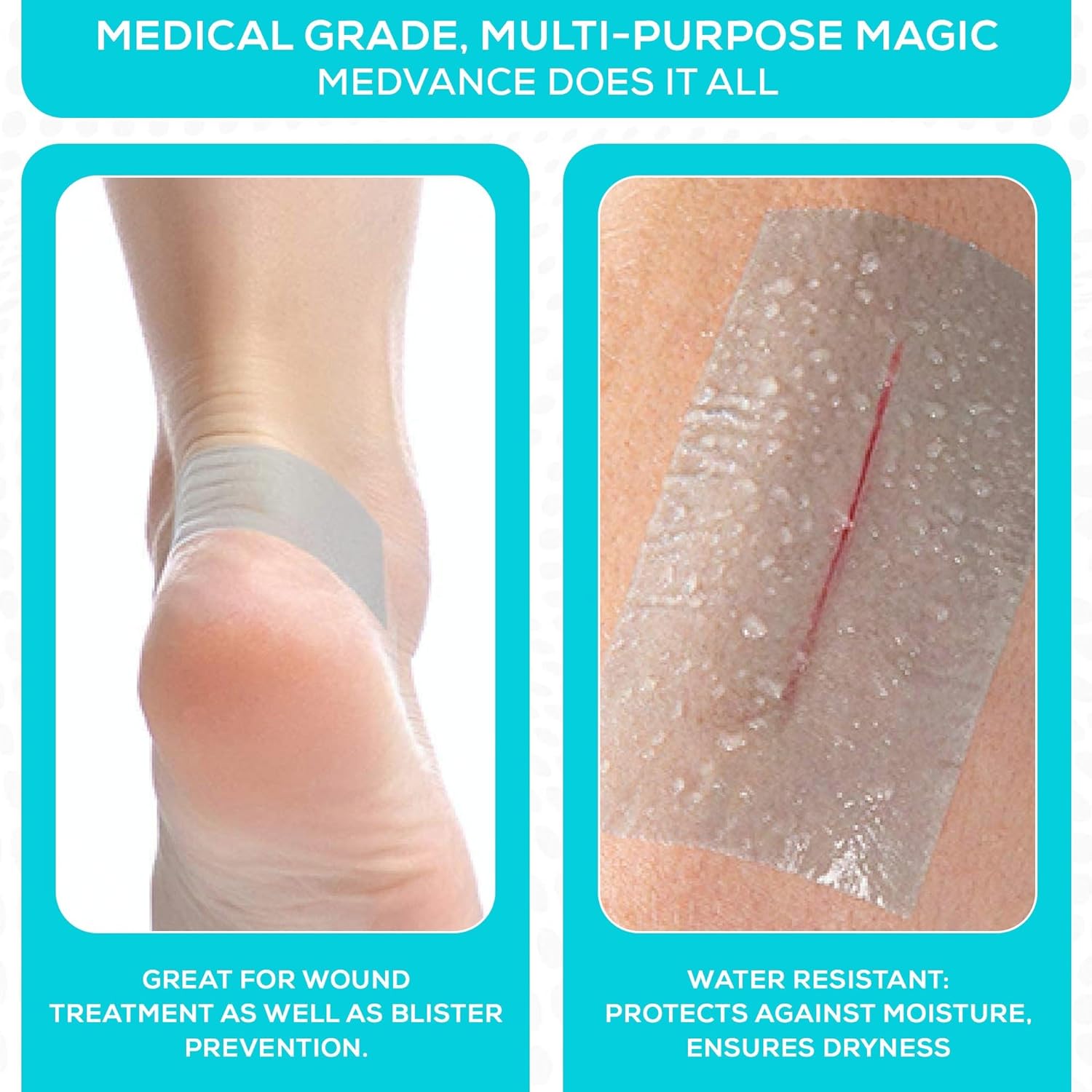 Detalle 2 de MedVance V5000115-1-Stickerless Silicone Medical Tape, 2 in x 1.5 ft