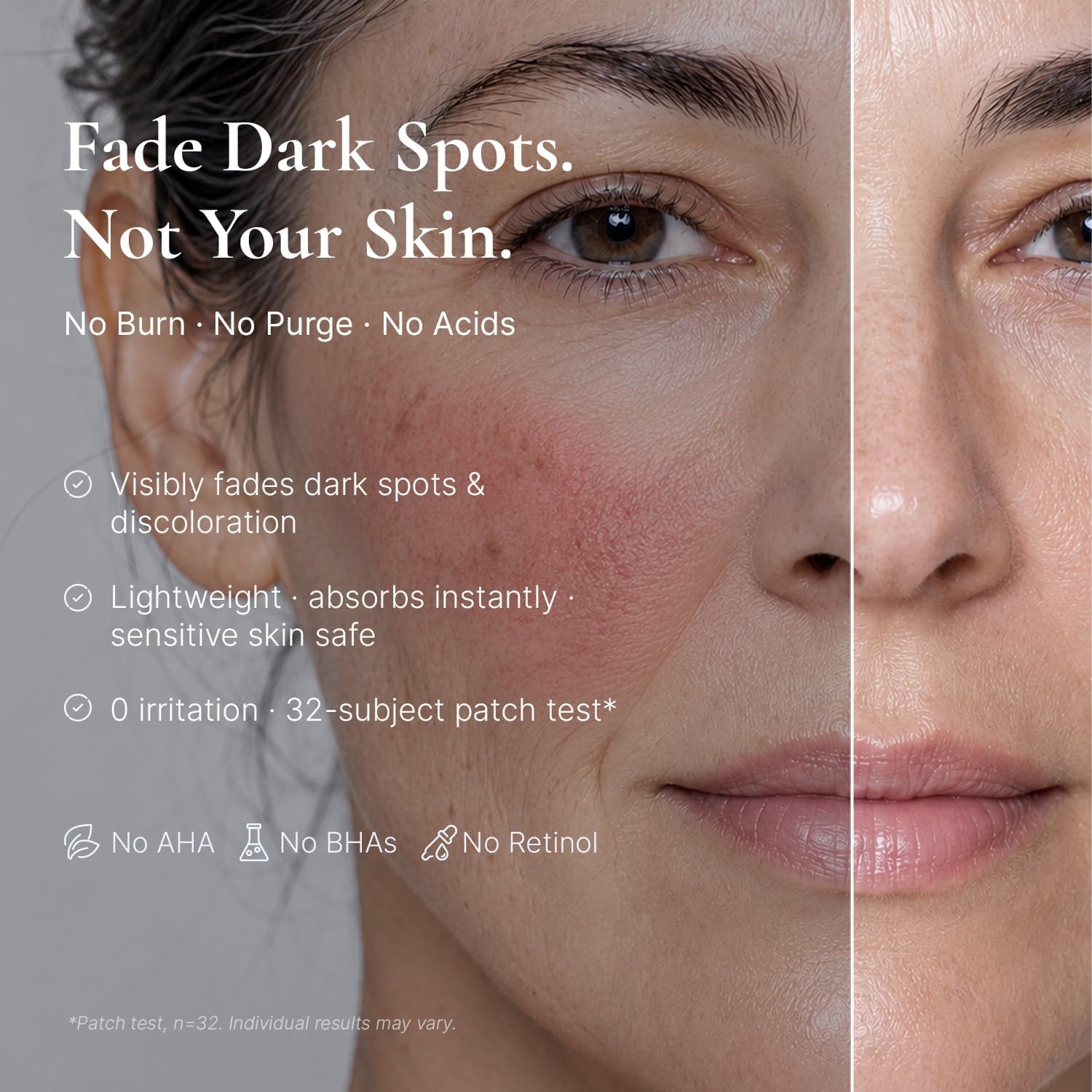 Detalle de EnaSkin Dark Spot Corrector Serum for Face & Body, Niacinamide, 30 mL