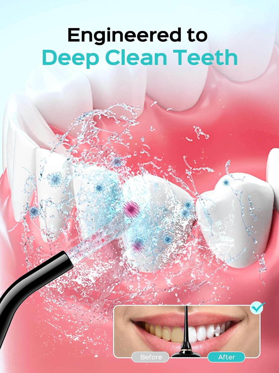 Detalle 2 de COSLUS Water Flosser 5‑tip cordless for braces 🦷