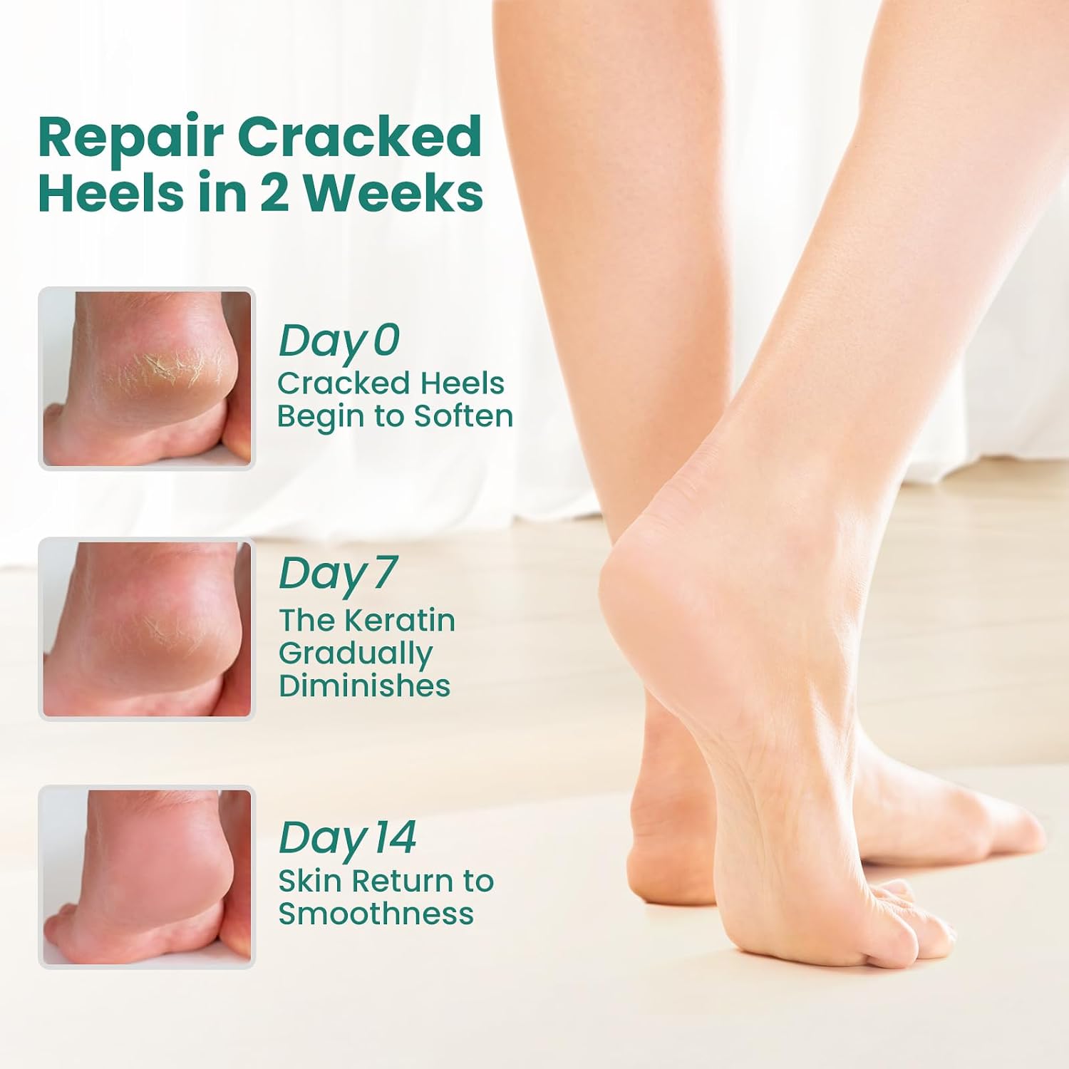 Thumbnail 1 de Welnove Moisturising Heel Socks 2 Pairs