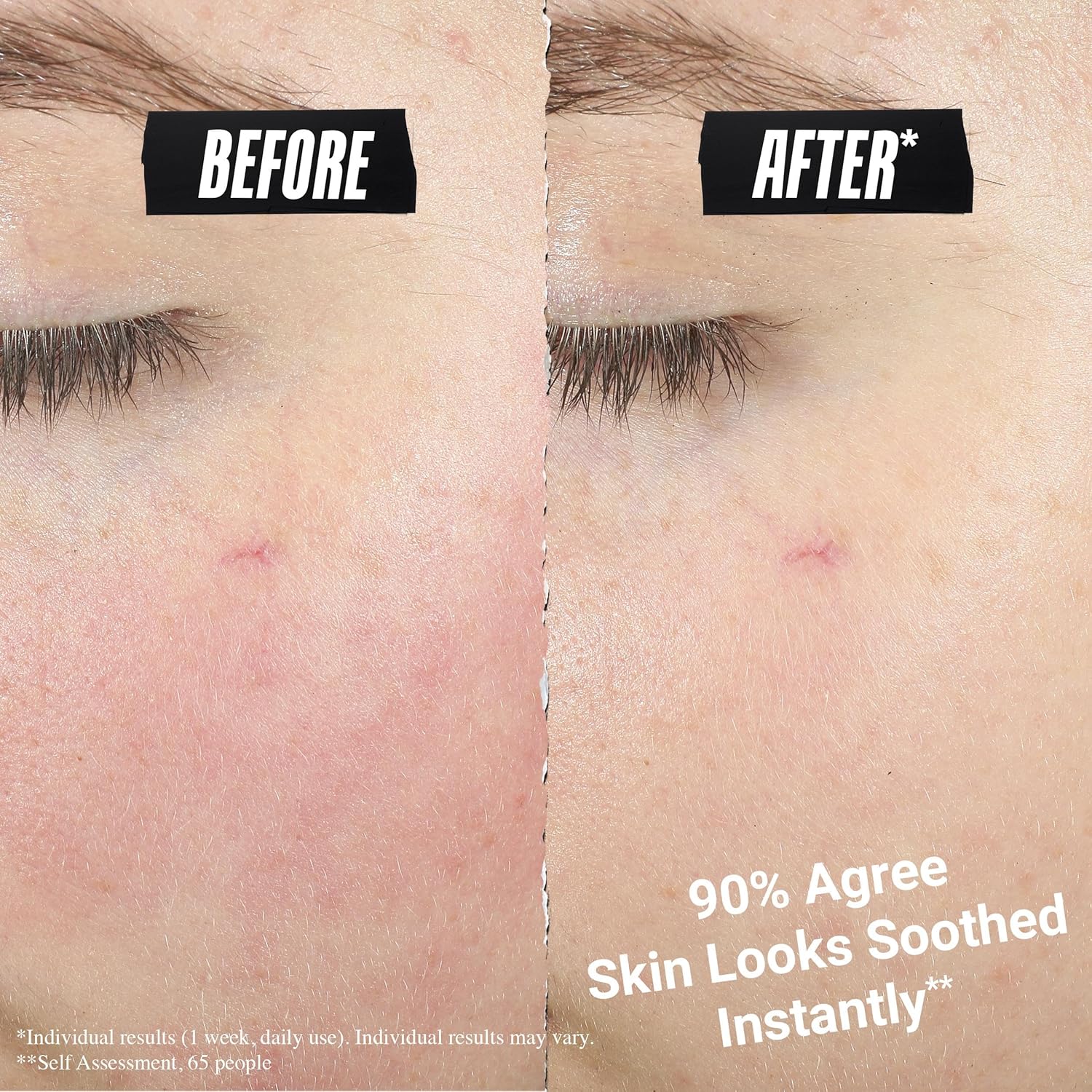 Thumbnail 5 de Kiehl’s Ultra Facial Meltdown Recovery Cream – Colloidal Oatmeal Skin Protectant for Sensitive, Eczema‑Prone Skin