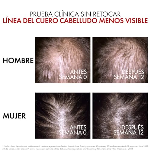 Thumbnail 6 de Vichy Aminexil Clinical R.E.G.E.N. Booster Serum anti-caída 90 ml