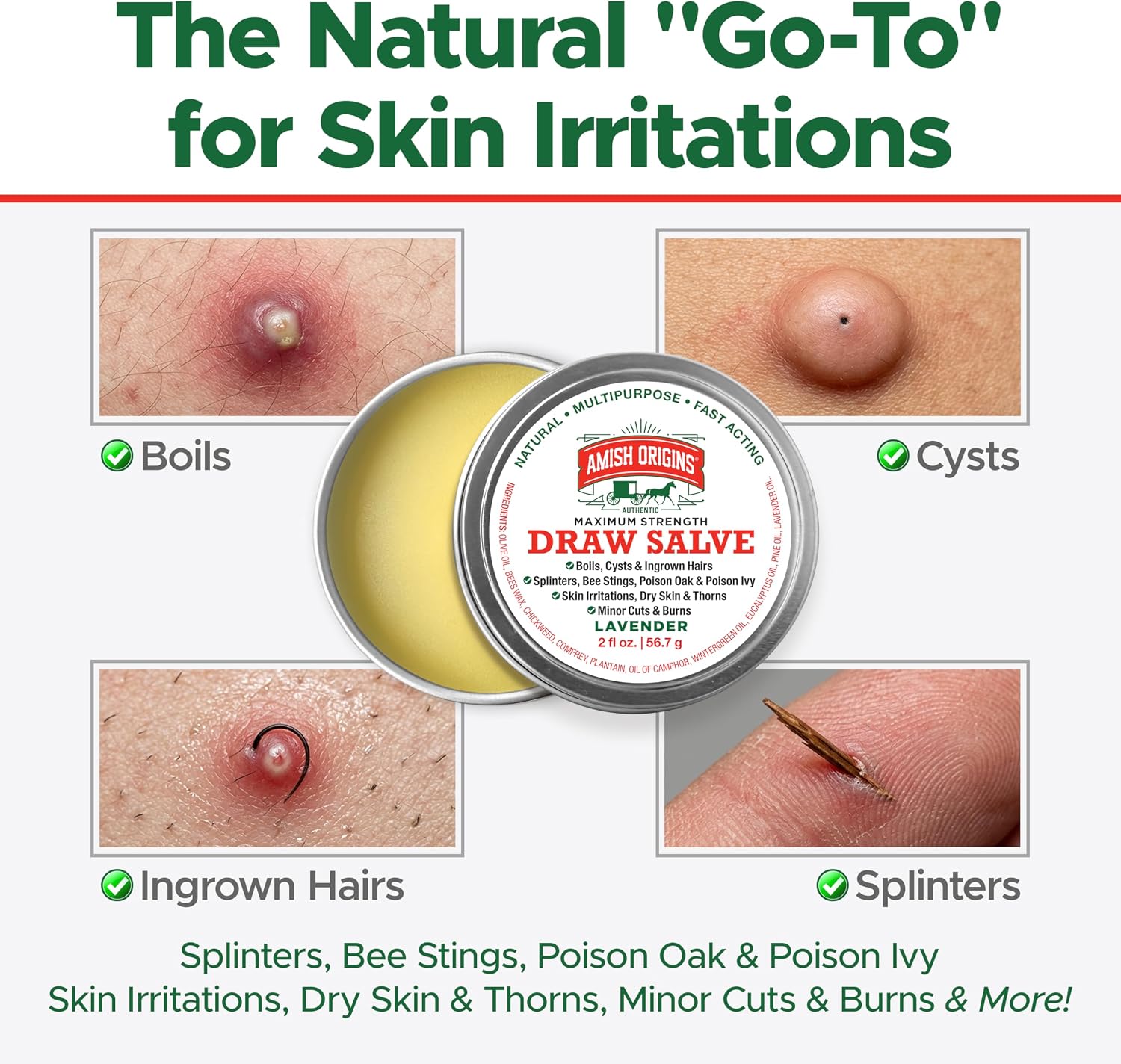 Detalle de Amish Origins Drawing Salve Ointment, 2 oz for Splinters and Itchy Skin