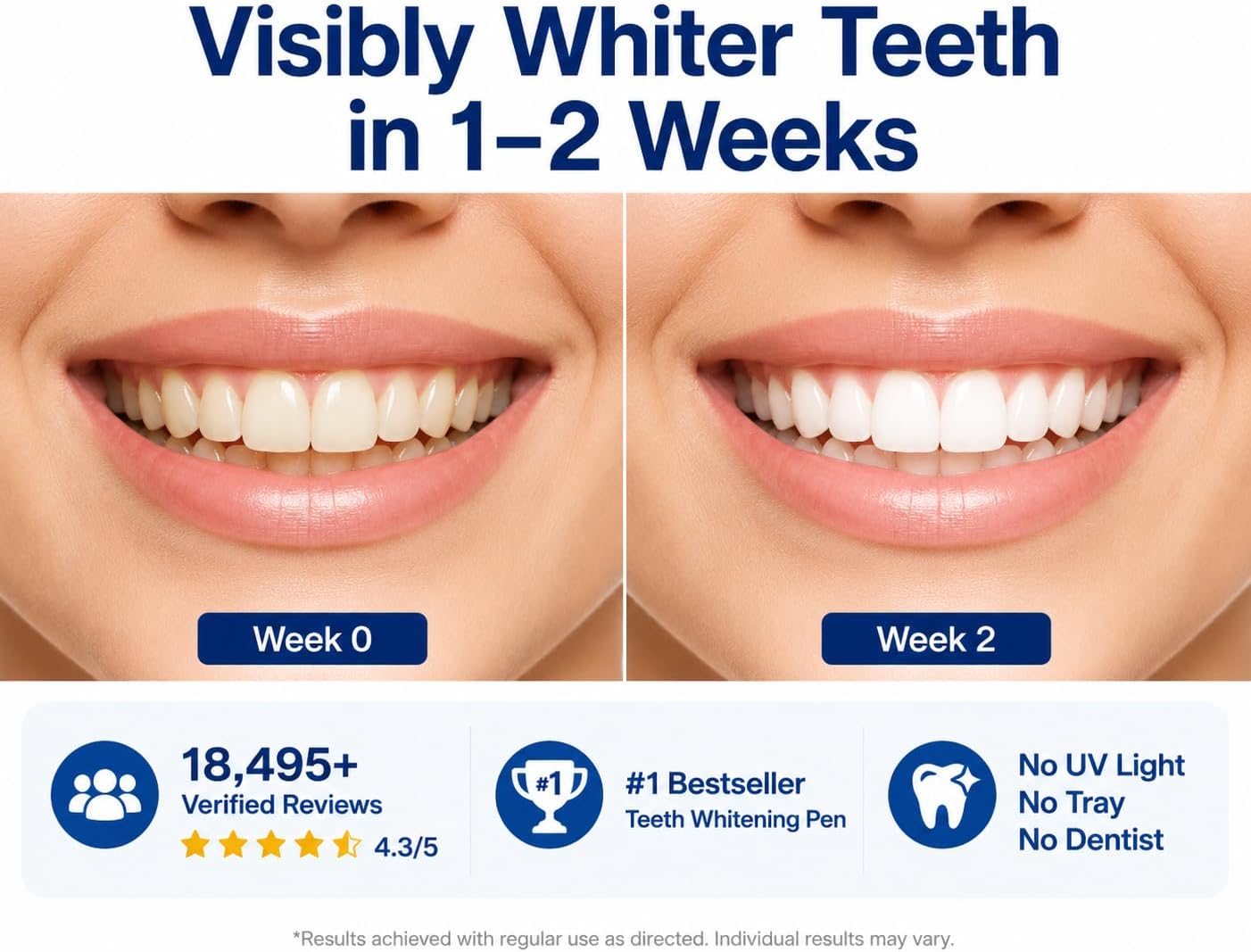 Detalle de VieBeauti Teeth Whitening Pen Kit, 5-Pack