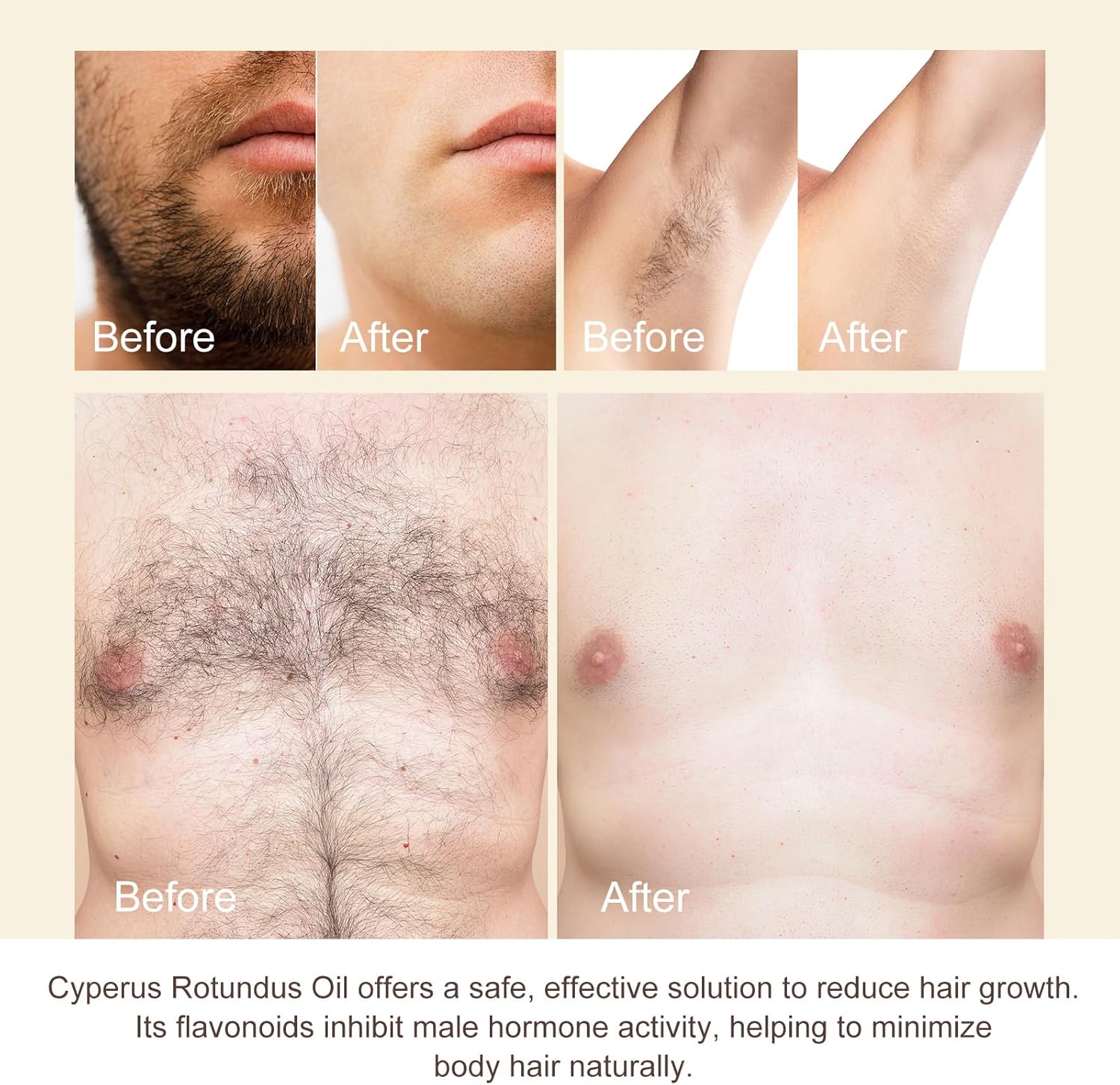 Detalle de Olio di Cyperus Rotundus 60 ml per depilazione – idrata, lenisce e può ridurre la ricrescita