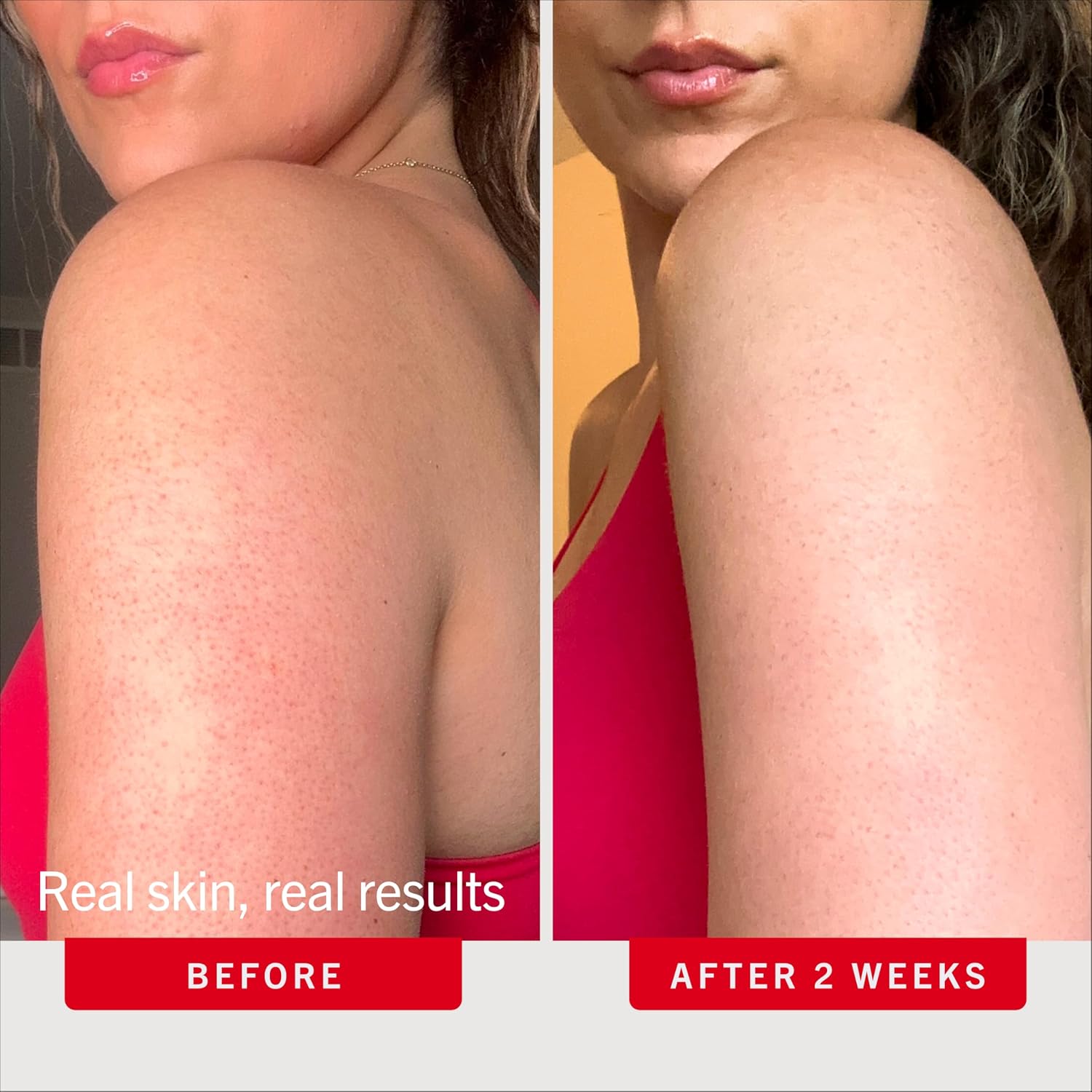 Detalle 2 de First Aid Beauty KP Bump Eraser Body Scrub, 10% AHA Exfoliator