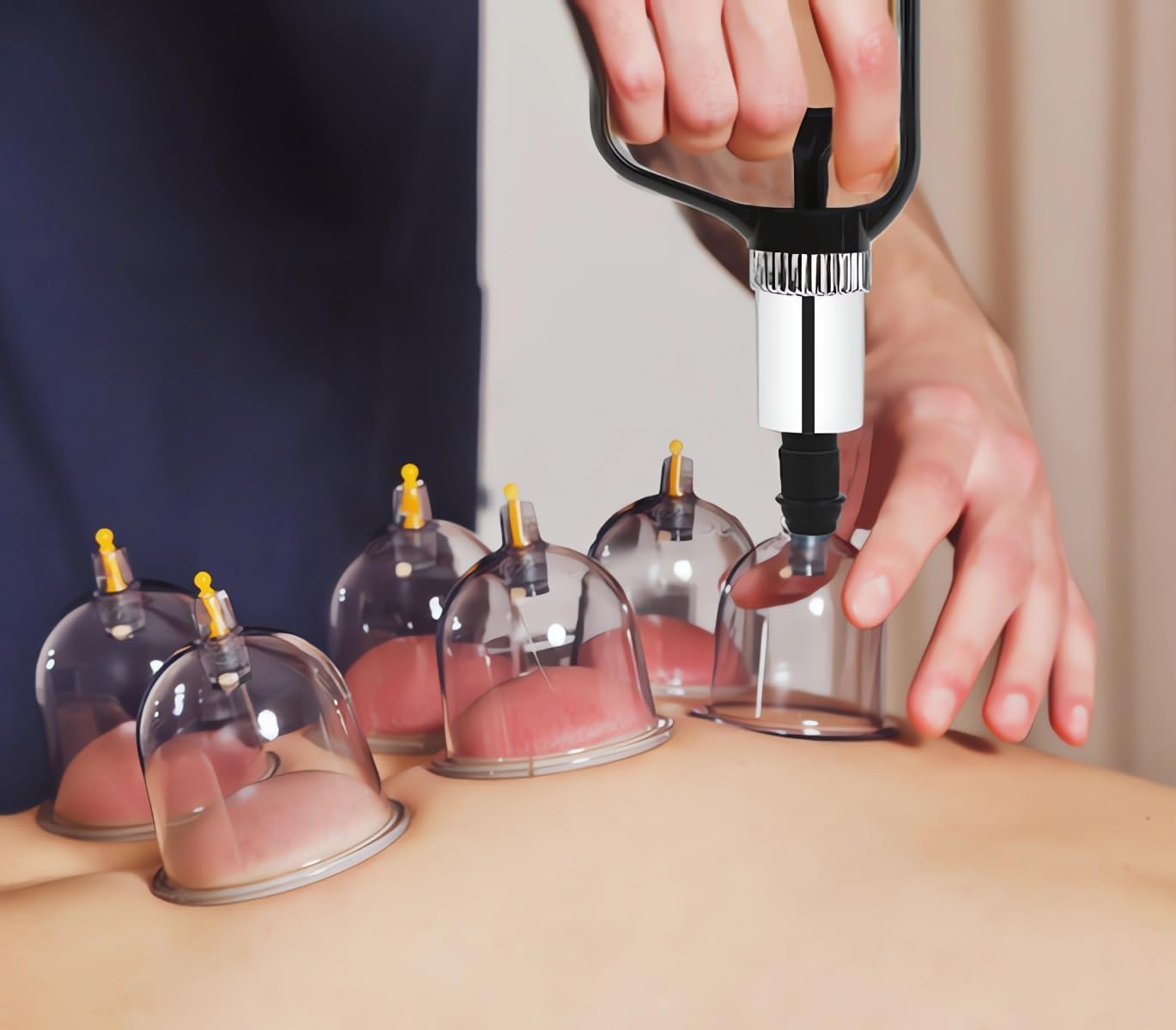 Detalle 2 de OBLITOP Large Size V2.0 Cupping Therapy Set, 22 Cups and Hand Pump