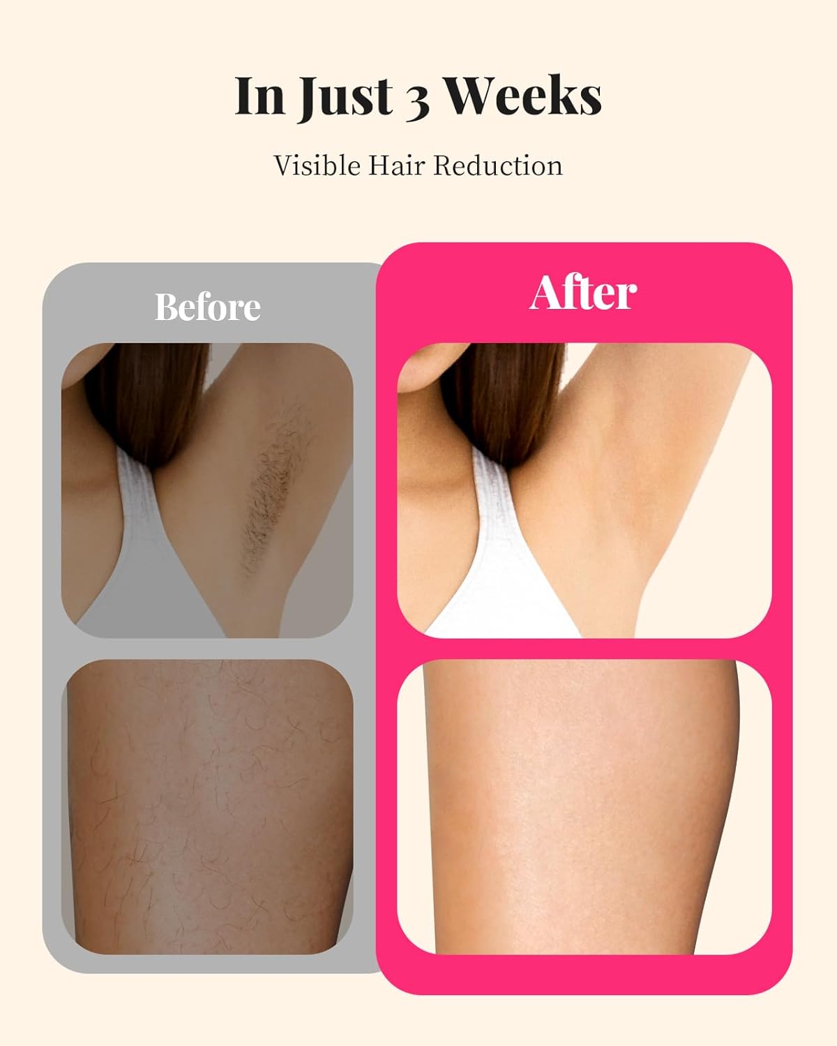 Thumbnail 1 de Haarlosy IPL Laser Hair Removal Device with 9 Levels (White Gold) for Home Use