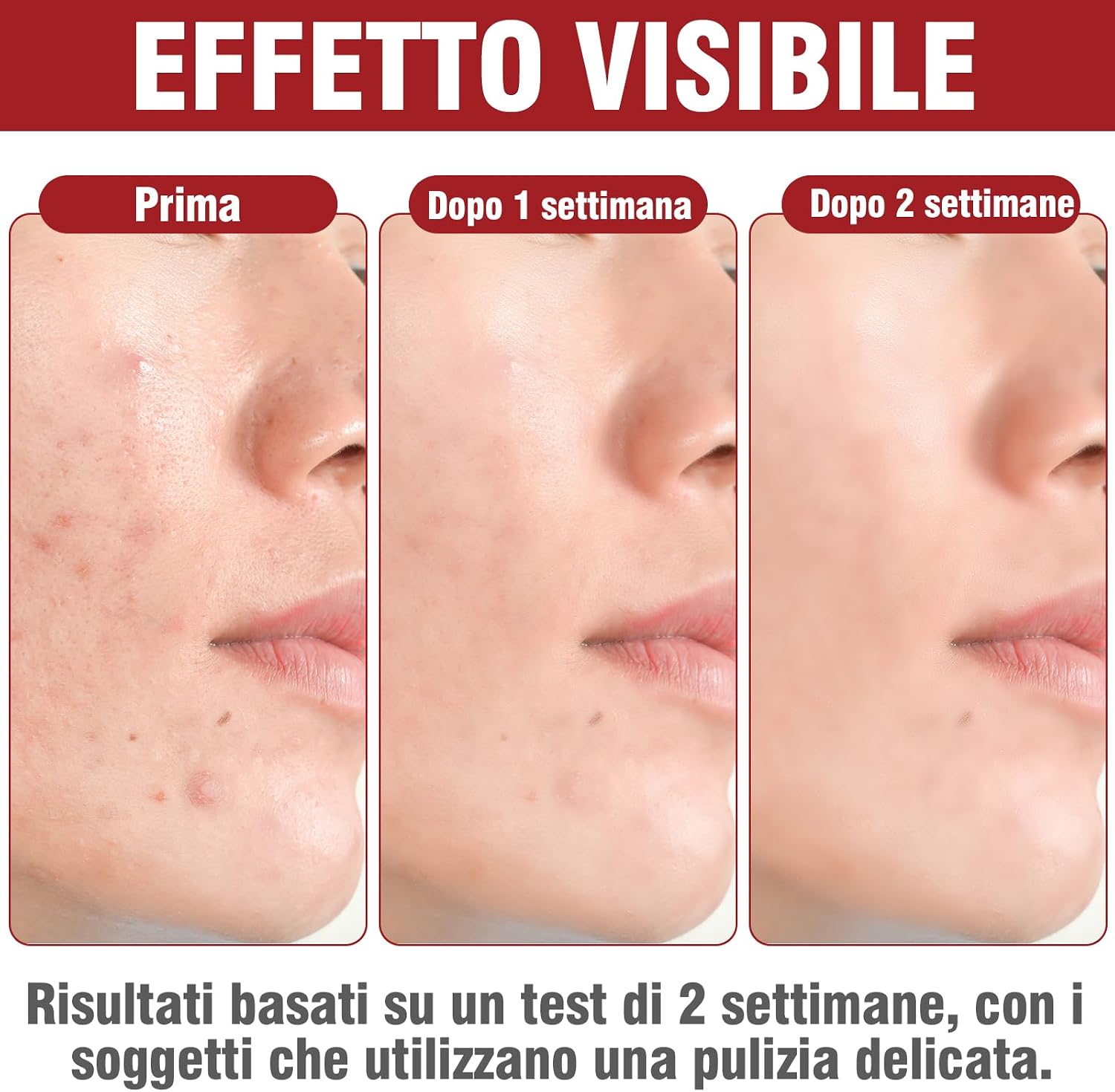 Thumbnail 1 de Crema Brufoli Viso 35g Acne Potentissima
