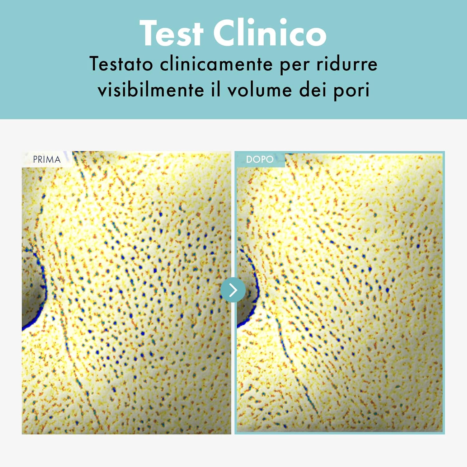 Detalle de TOSOWOONG crema raffinatrice di pori per il viso, riduce e minimizza l’aspetto dei pori (50 g)