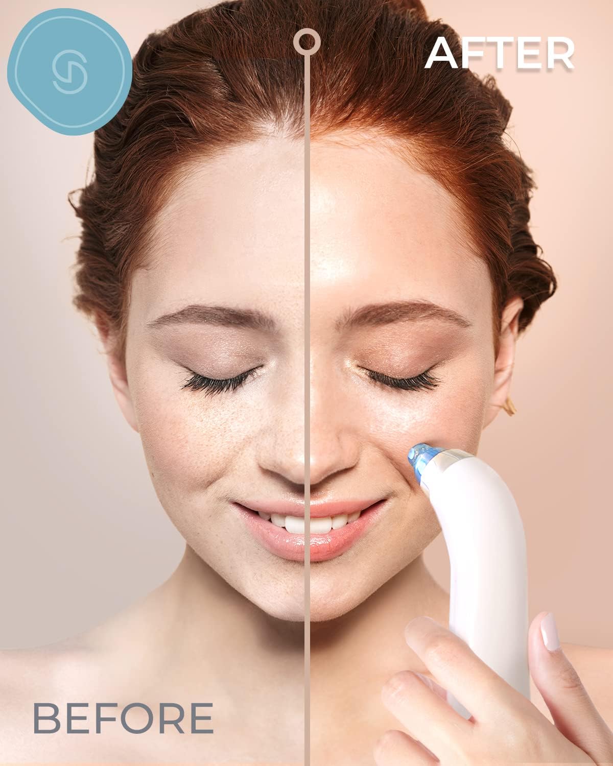 Detalle de ESSY Blackhead Remover Vacuum Pore Cleaner with Deep Suction & 4 Probes