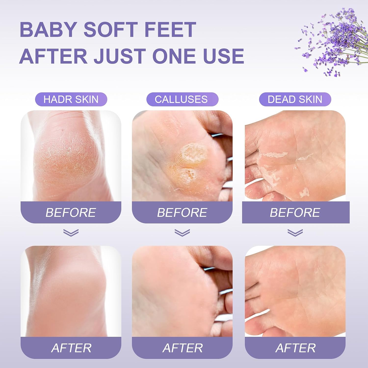 Thumbnail 3 de FUNNIR Foot Peeling Mask 5 Pack Exfoliant