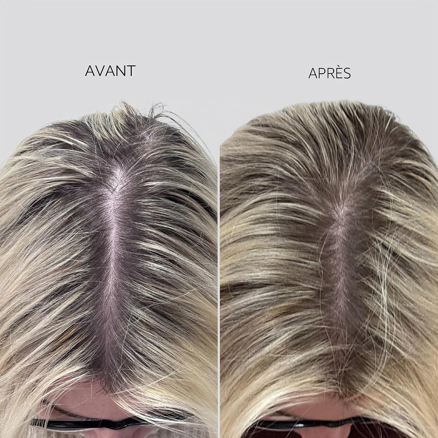Thumbnail 6 de Nanogen Hair Growth Factor Treatment – sérum pour la pousse des cheveux à l’extrait de pea sprout, écorce et peptides (30 ml)