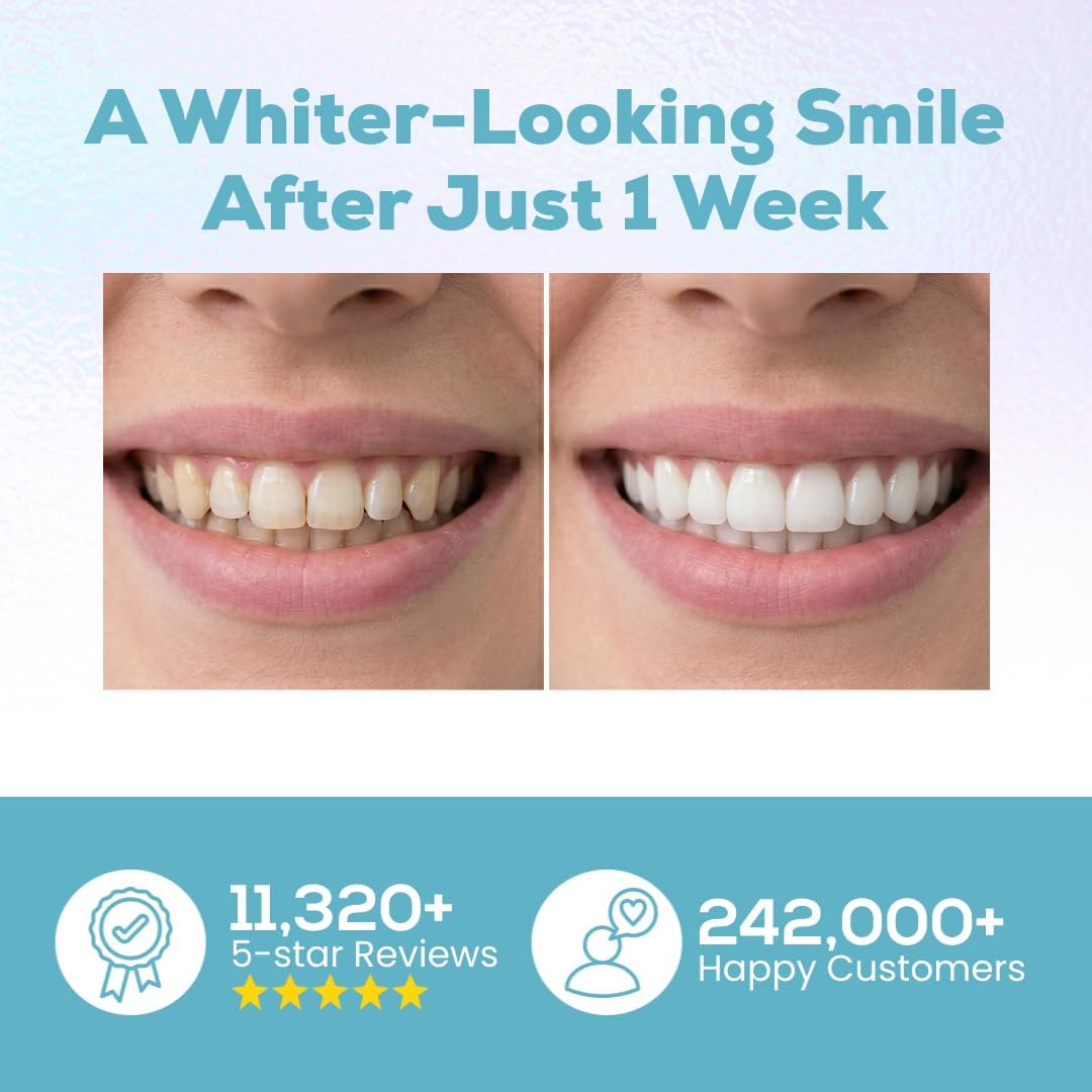 Detalle 2 de Venus Visage Teeth Whitening Pen, 20+ Uses ⚙