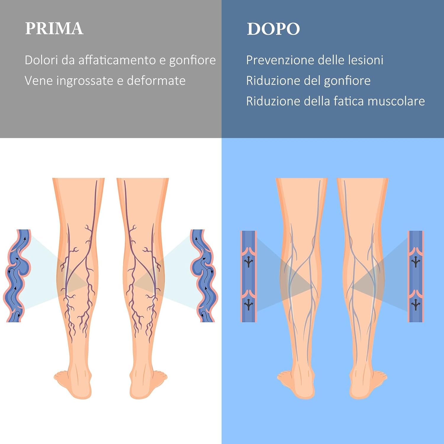 Detalle 2 de Calze a compressione graduata 20-30 mmHg unisex con cerniera e punta aperta (taglie forti)
