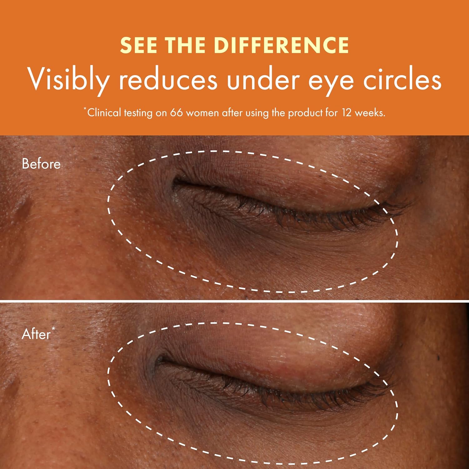 Thumbnail 6 de Origins GinZing Brightening Eye Cream with Vitamin C: practical, non-hyped analysis