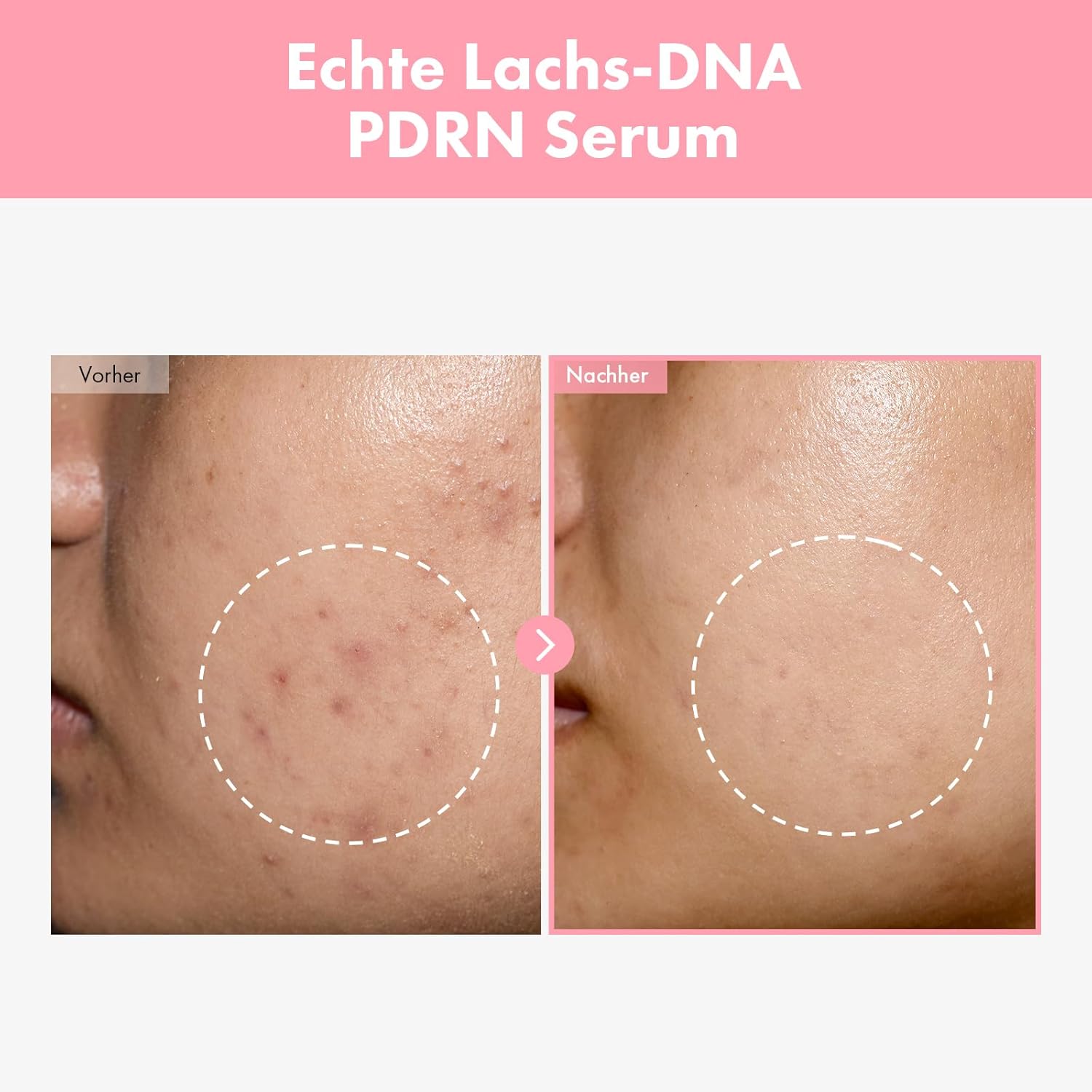 Detalle 2 de TOSOWOONG Pink Peptide 12 Serum 33ml