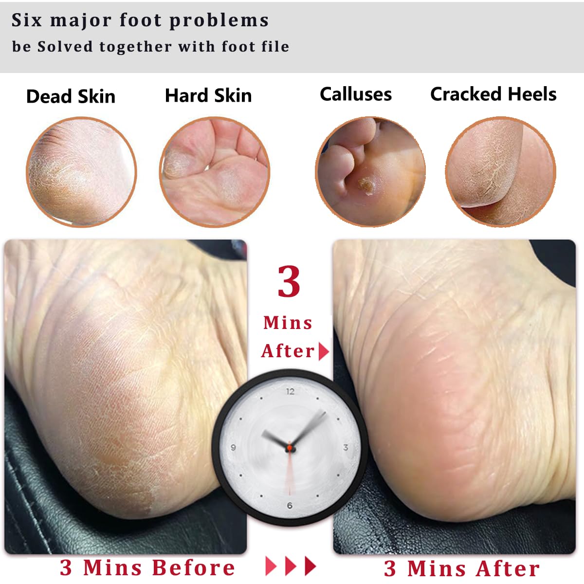 Detalle de Kinepi Foot File & Foot Scrubber, Double-Sided Corundum Surface, Beech Handle