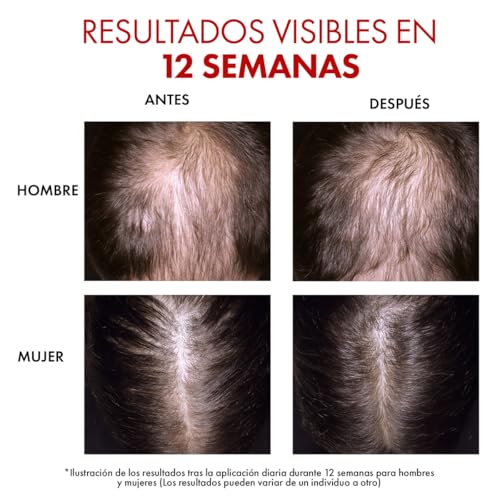 Thumbnail 6 de Vichy Dercos Aminexil Clinical R.E.G.E.N. Booster: Siero Rinnovatore per Capelli - 90 ml