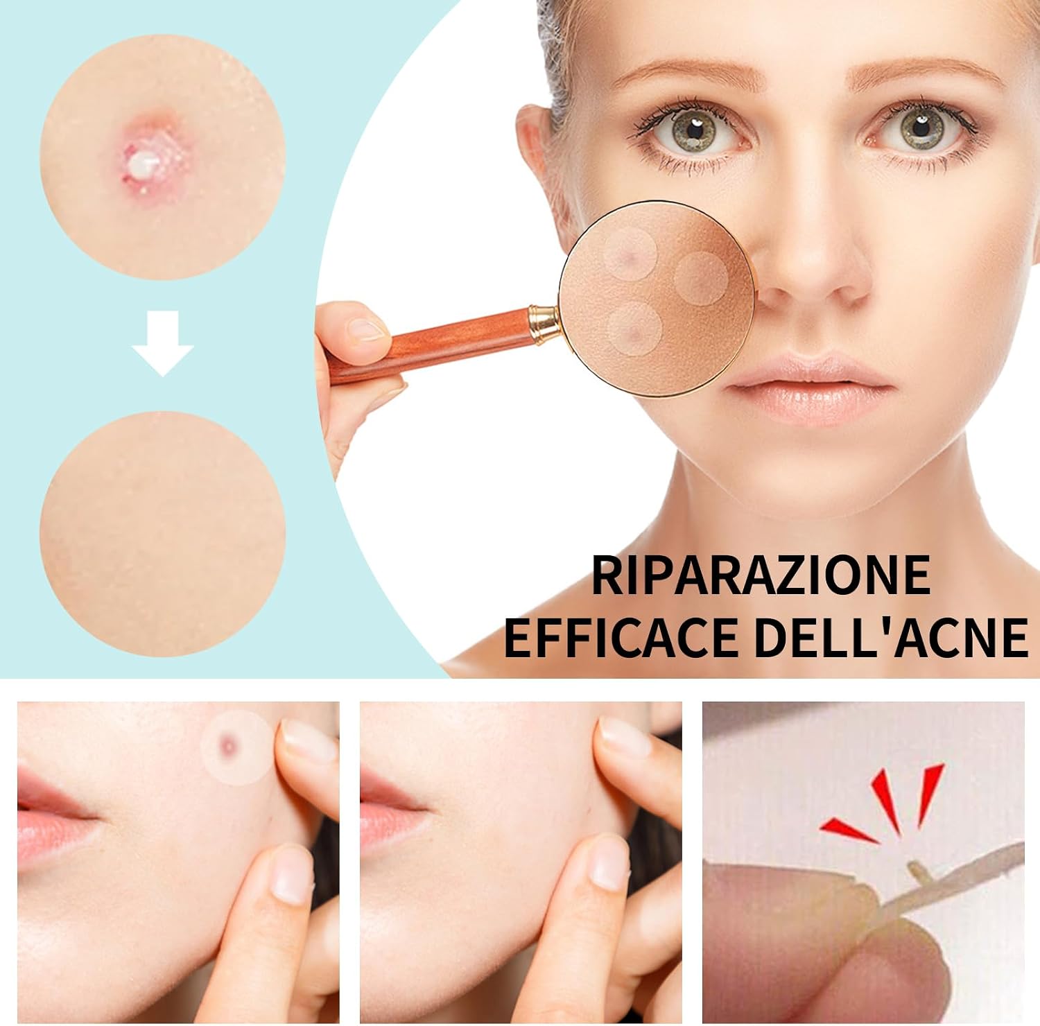 Thumbnail 4 de Home Holic Patch Brufoli in Idrogel 2-in-1 Giorno e Notte, cerotti invisibili e traspiranti per acne (528 pz)