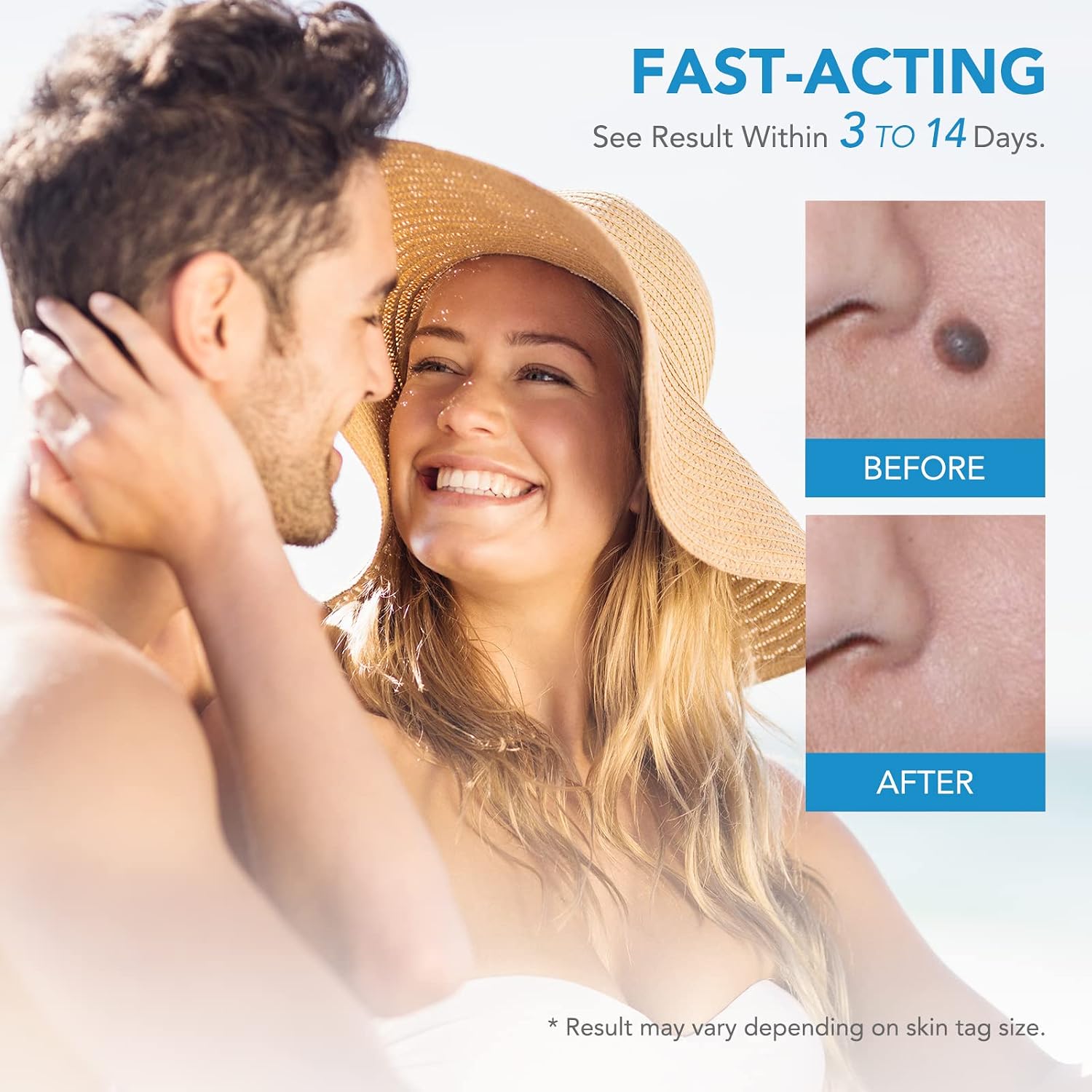 Detalle de BAOXIAOBEN skin tag removal kit pen 40 bands