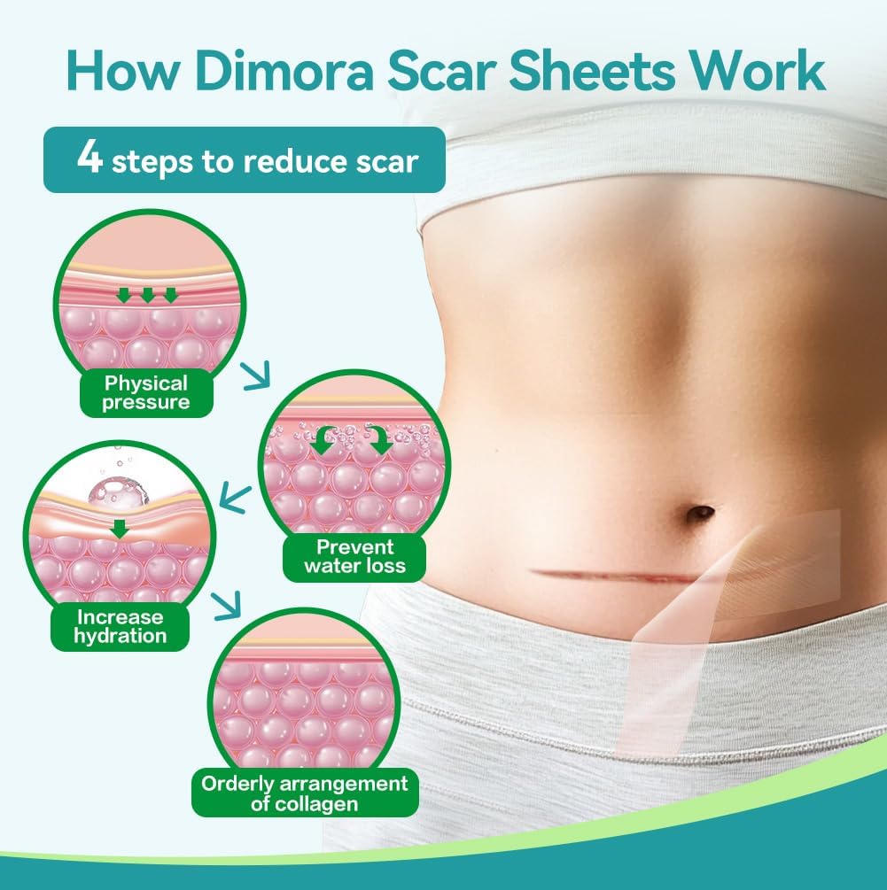 Thumbnail 4 de Dimora Medical Grade Silicone Scar Sheets (4cm x 3m) for waterproof scar treatment